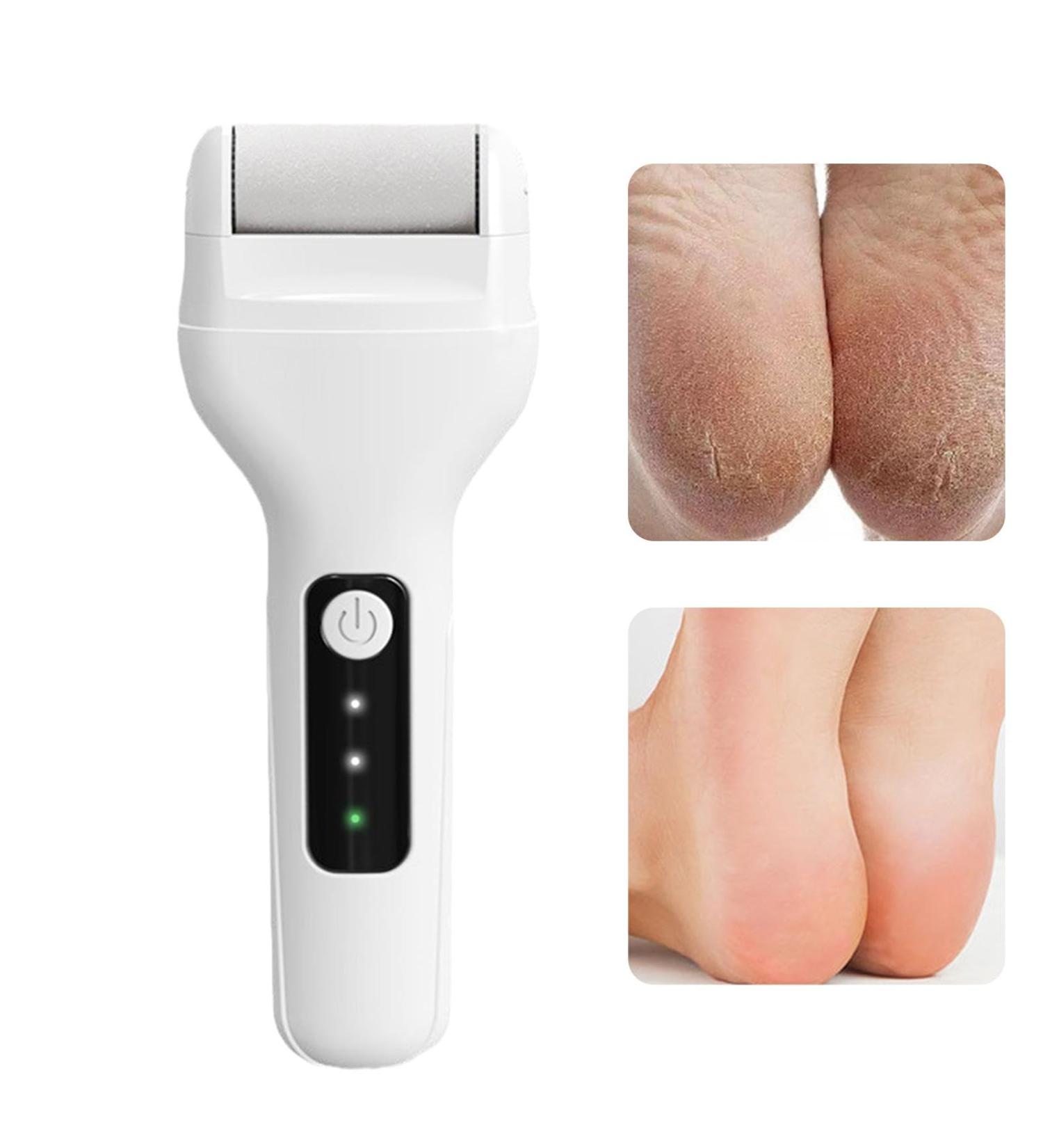 Electric Foot File | Skin-Friendly Foot Callus Remover Foot Scrubber Dead Skin Feet Scrubber Automatic Powerful Heel Scraper for Cracked Heels Feet Hard Cracked Dry - Buy Online on GoSupps.com