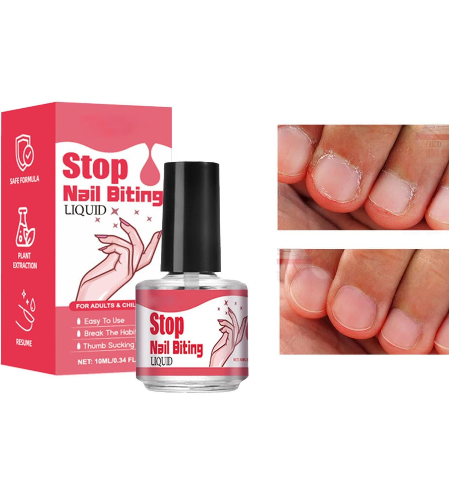 Nail Biting Prevention 10ML Fingernail Biting Polish - Stop Biting Nails Stop Nail Biting Solution Safe Long-Lasting For Kids And Adults To Curb Nail Biting - Buy Online on GoSupps.com