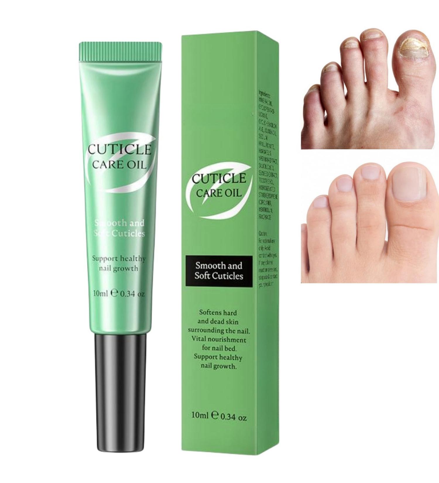 10ml Nail & Cuticle Oil Pen Natural Ingredients Nail Oil Pen Deeply Hydrating Moisturising Cuticle Oil for Nails Moisturizing Nail Oil with Soft Brush Nail Strengthener Clear Nail Polish Strengthening - Buy Online on GoSupps.com