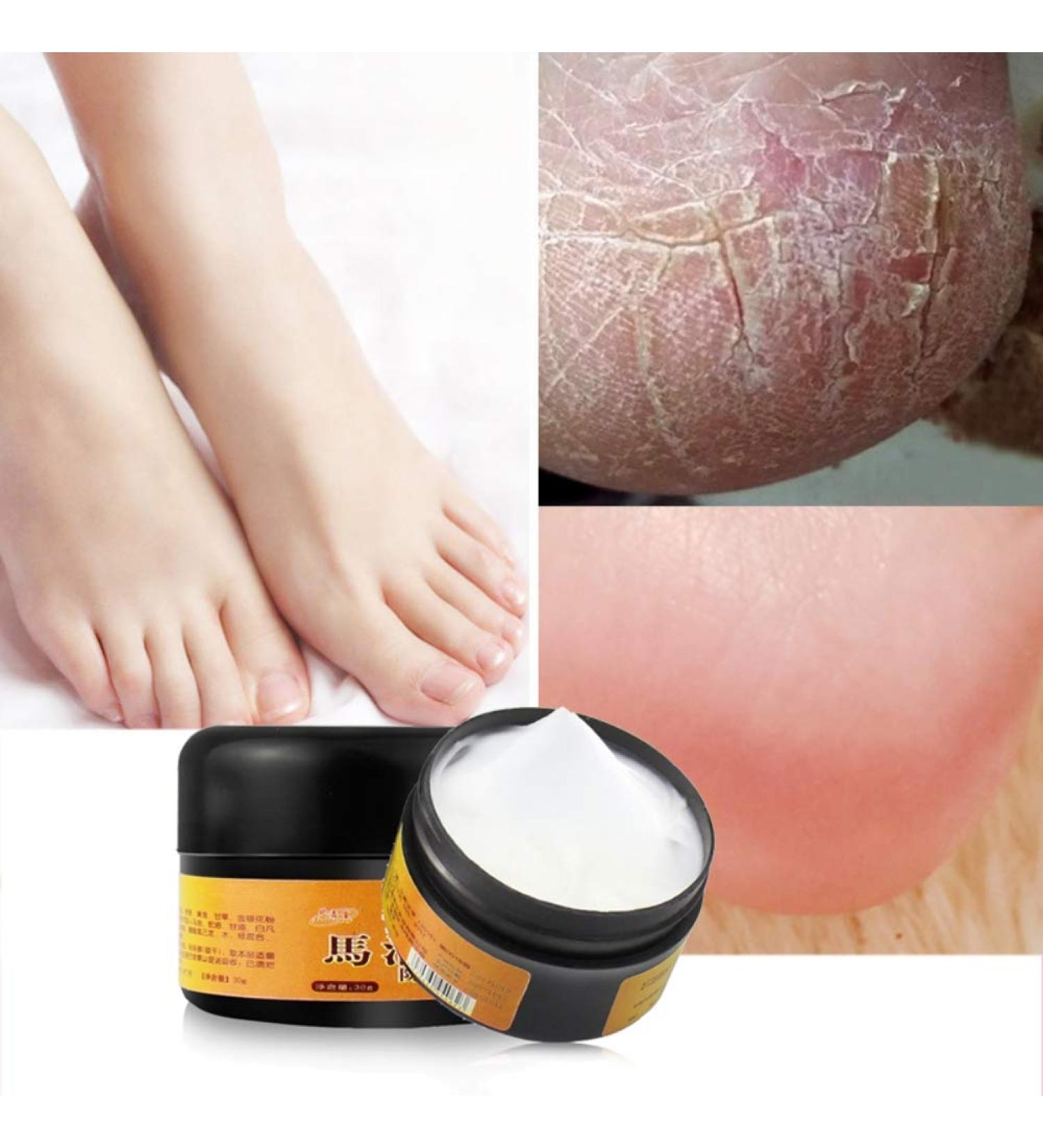AllbestAye Foot Repair Cream - Heal Cracked Heels & Dry Feet | Moisturizing Callus Care for Soft Skin - 50g - Buy Online on GoSupps.com