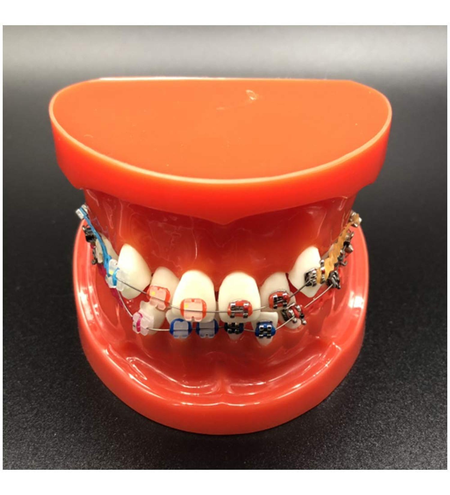 Dytah Toothpodont - Orthodontic Teeth Model with Mental Brackets & Ligature Ties | Red Study Tool for Teaching & Learning - Buy Online on GoSupps.com