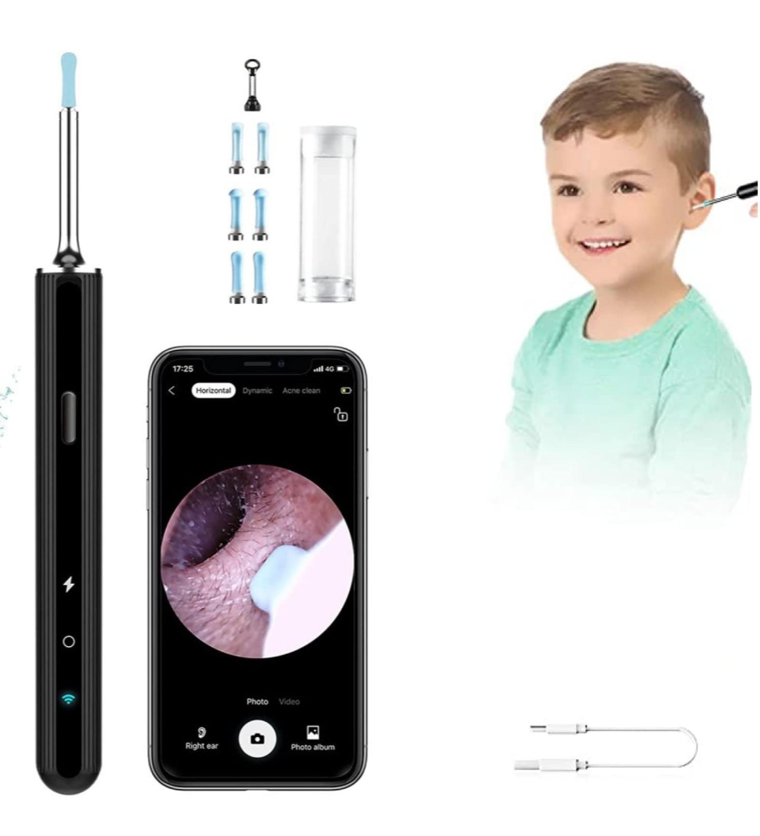 QDCFY Ear Wax Removal Set with 3.5mm Camera 6 LED Lights - Safe Ear Cleaning Tools for Adults Children & Babies (Black) - Buy Online on GoSupps.com