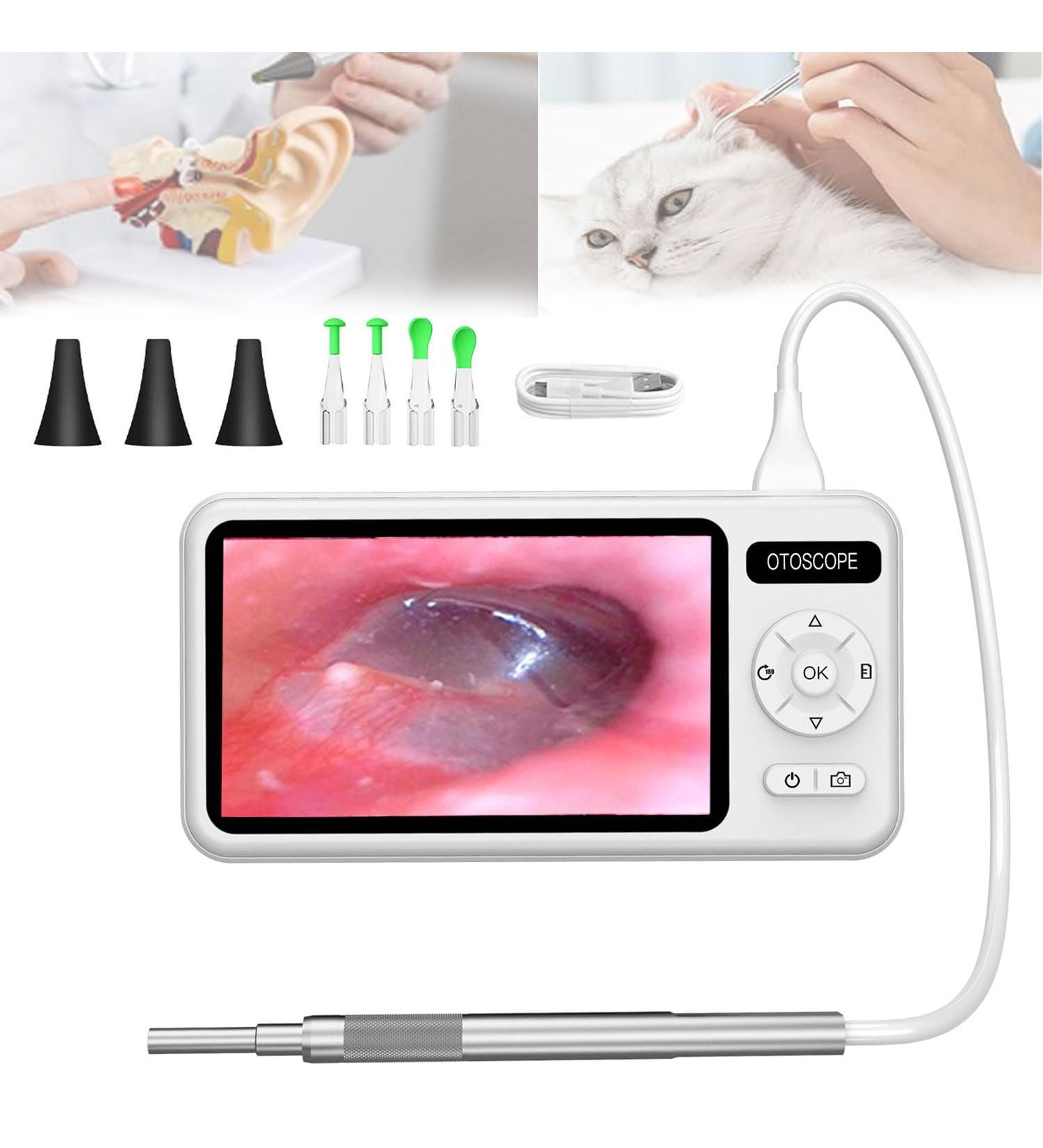 5 Inch Otoscope Ear Camera 3.9mm Diameter Ear Endoscope Ear Wax Removal Tool with 6 Adjustable LED Lights and Ear Tip Cleaning Kit Supports Photo Snap and Video Recording for Home - Buy Online on GoSupps.com