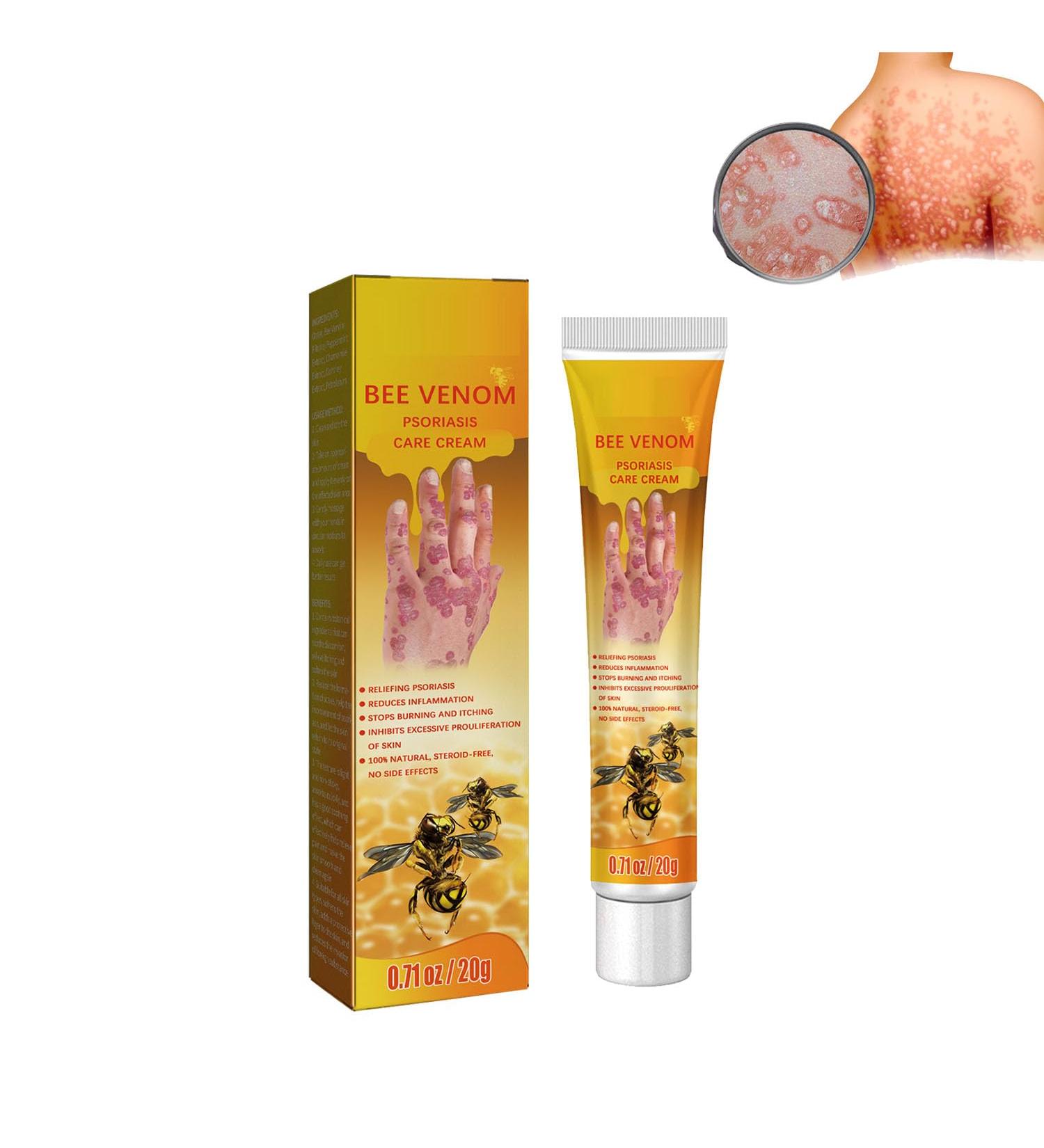 New Zealand Youth Bee Venom Psoriasis Treatment Cream - Soothing & Moisturizing | For All Skin Types - Buy Online on GoSupps.com