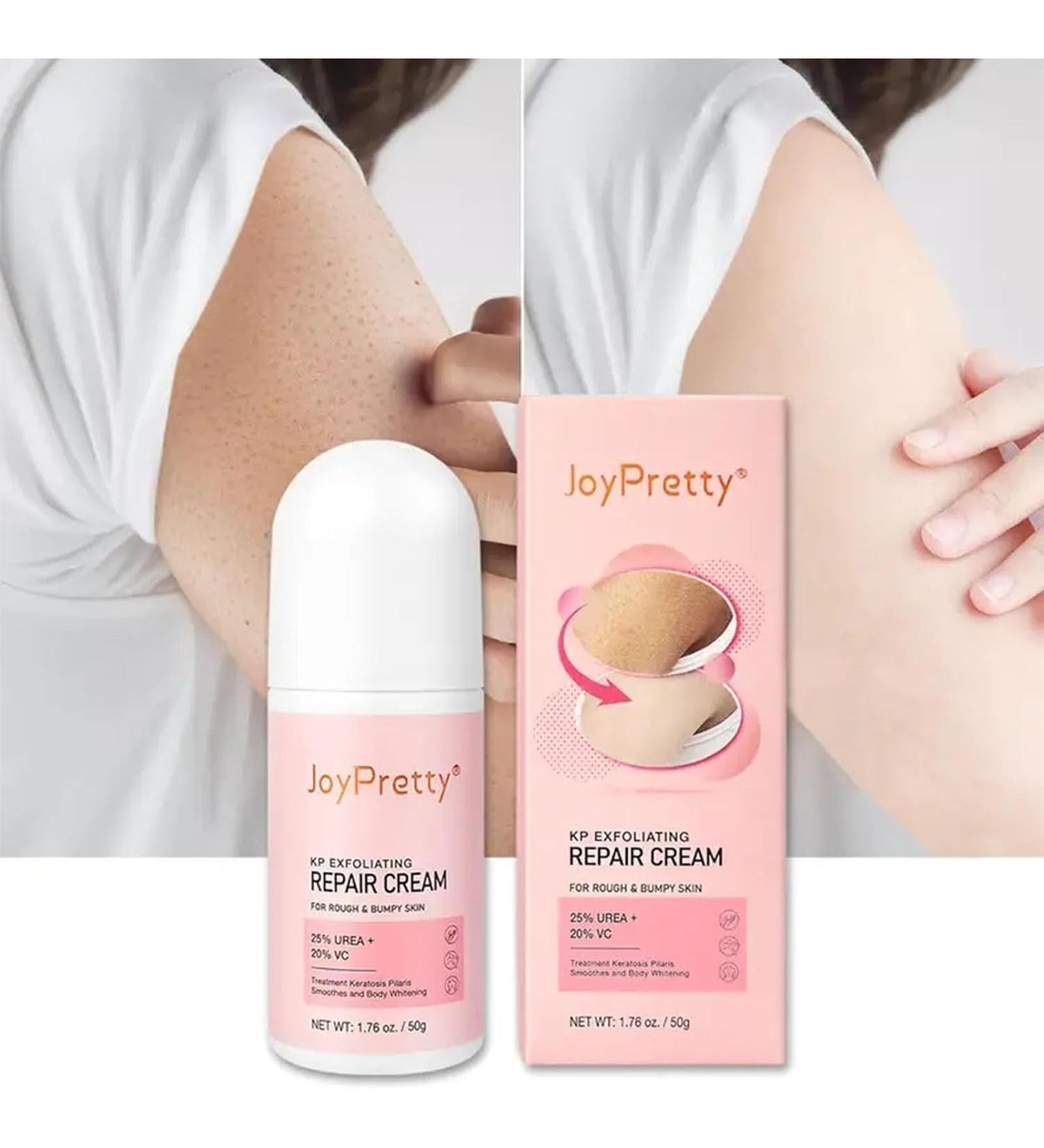 Keratosis Pilaris Lotion Legs Treatment Body Cream Skin Exfoliating Repair Cream Chicken Skin Care Cream Exfoliating Body Cream Rough Bumpy Skin Body Lotion Moisturizing Cream Gets Rid Of Redness - Buy Online on GoSupps.com
