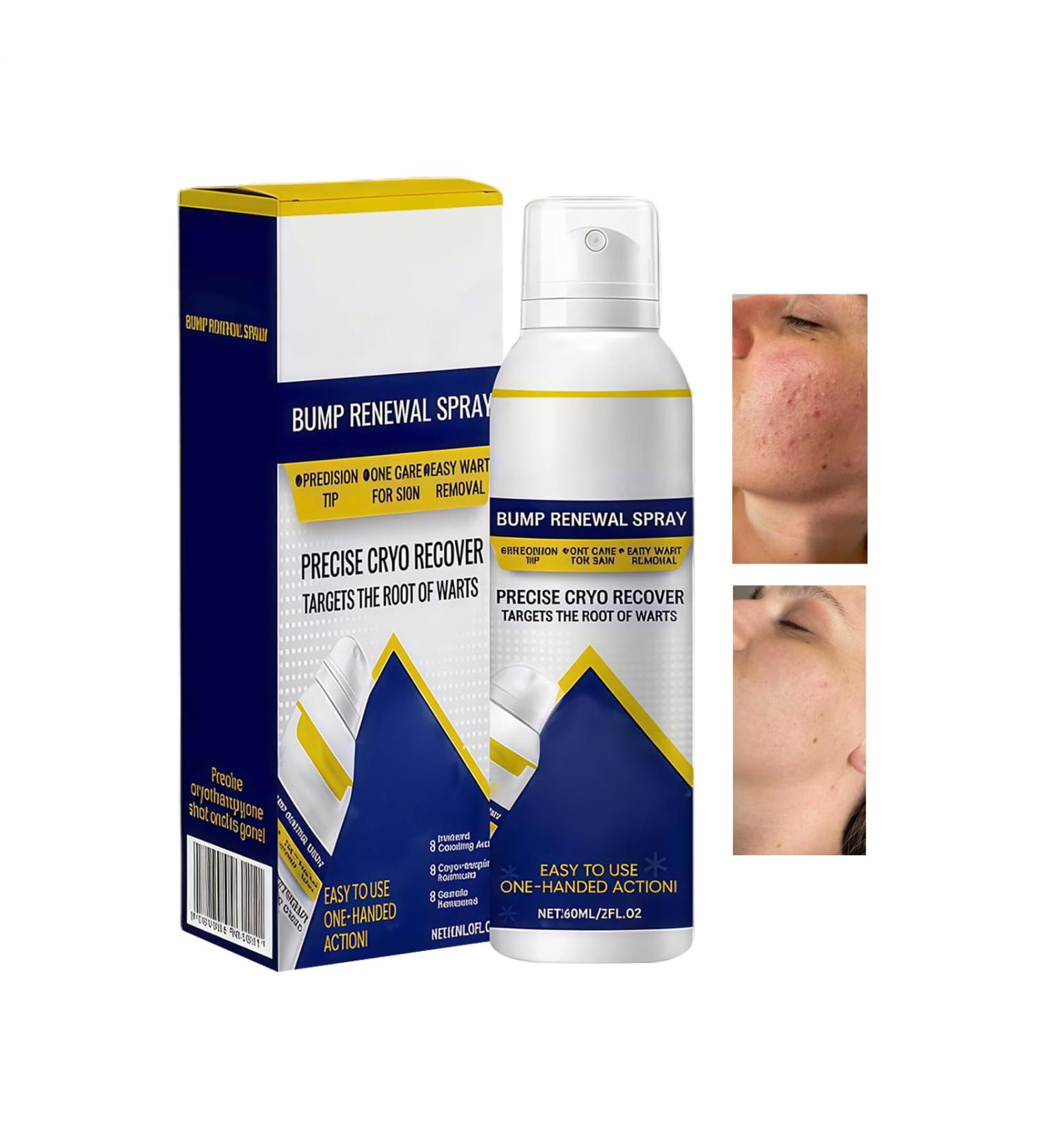  Bkljkf Soothing Spray for Skin Blemishes 60ml Natural Soothing Fast Absorbing Liquid Spray Care for Sensitive Skin for Women Men Teenagers and Young Adults - Buy Online on GoSupps.com