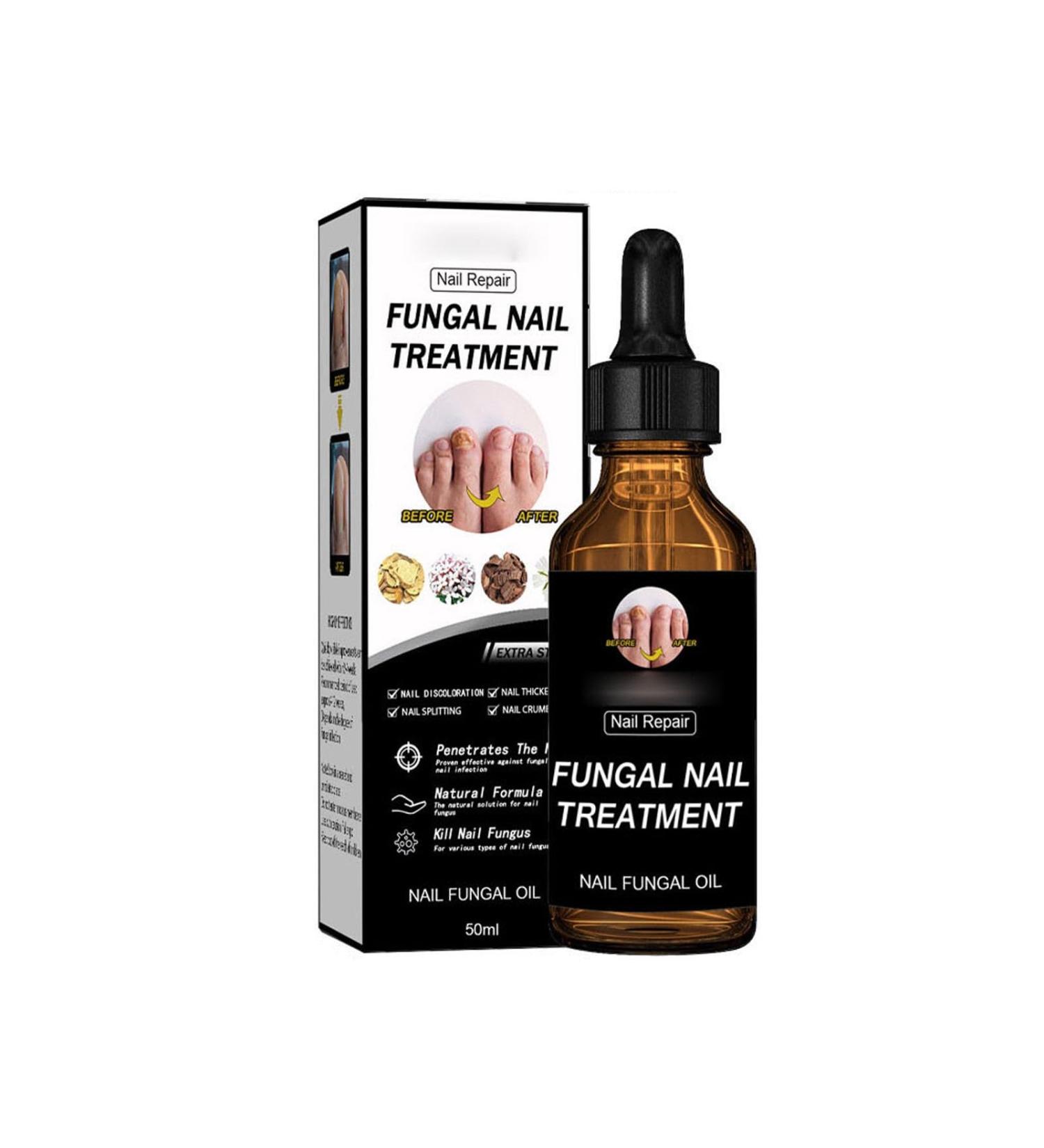 Nail Liquid Thickening Shiny Nails Grey Nails Dead Skin Moisturising Nail Nutrition Care Liquid 30ml 50ml CnJ78 (B One Size) 1 count (Pack of 1) b - Buy Online on GoSupps.com