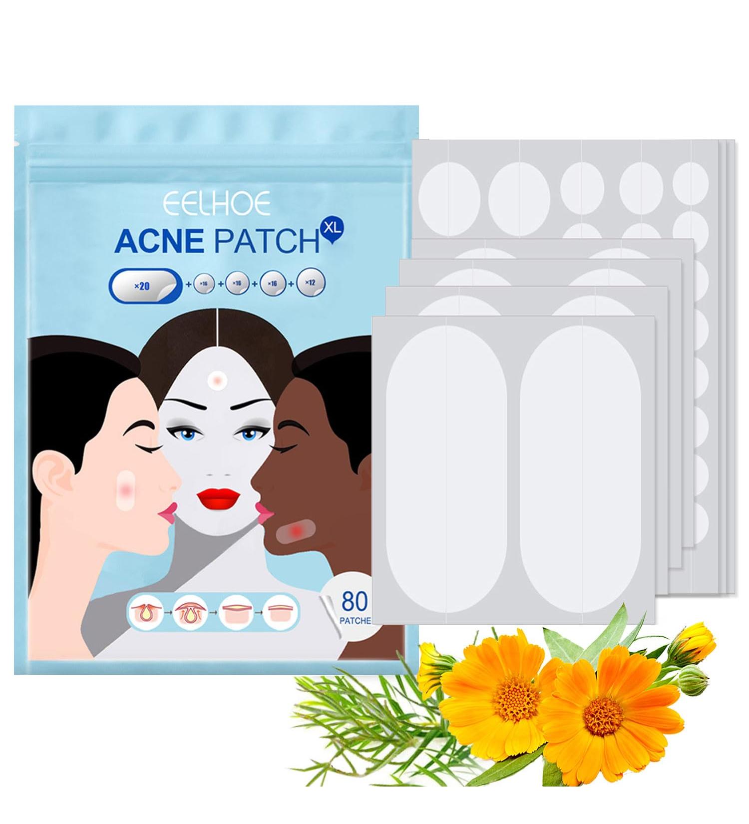 Pimple Patches Acne Stickers Hydrocolloid Patches Large Acne Stickers for Face Chin or Body Effectively Calms & Relieves Acne (80 Patches) - Buy Online on GoSupps.com