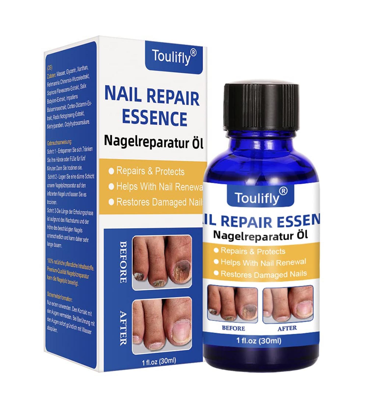 Nail Repair Natural Nail Care Maximum Strength Nail Solution Restores Discolored & Damaged Nails Nail Care Solution - Buy Online on GoSupps.com