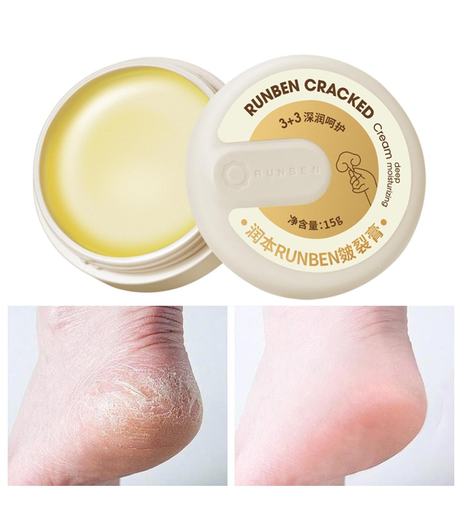  Linsition Exfoliating Foot Cream - Lotion for Dry and Cracked Feet 15 Exfoliating Foot Cream heals and moisturizes for healthy feet for extremely dry skin - Buy Online on GoSupps.com