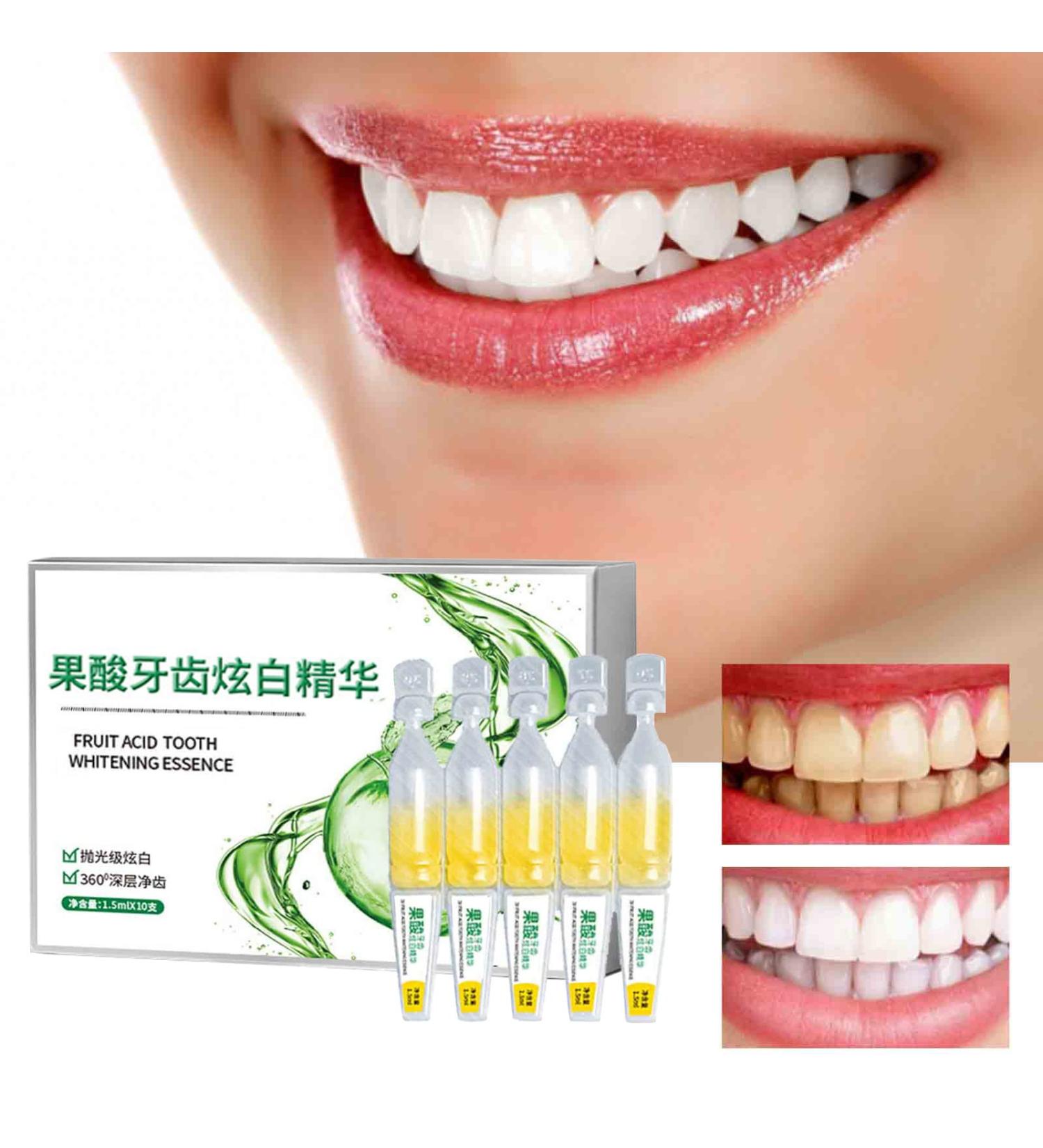 Buy Tlopa Ampoule Toothpaste & Serum - 3V Fruit Acid Whitening Tartar Removal - 20 Disposable Pieces for Bright Smiles - Buy Online on GoSupps.com