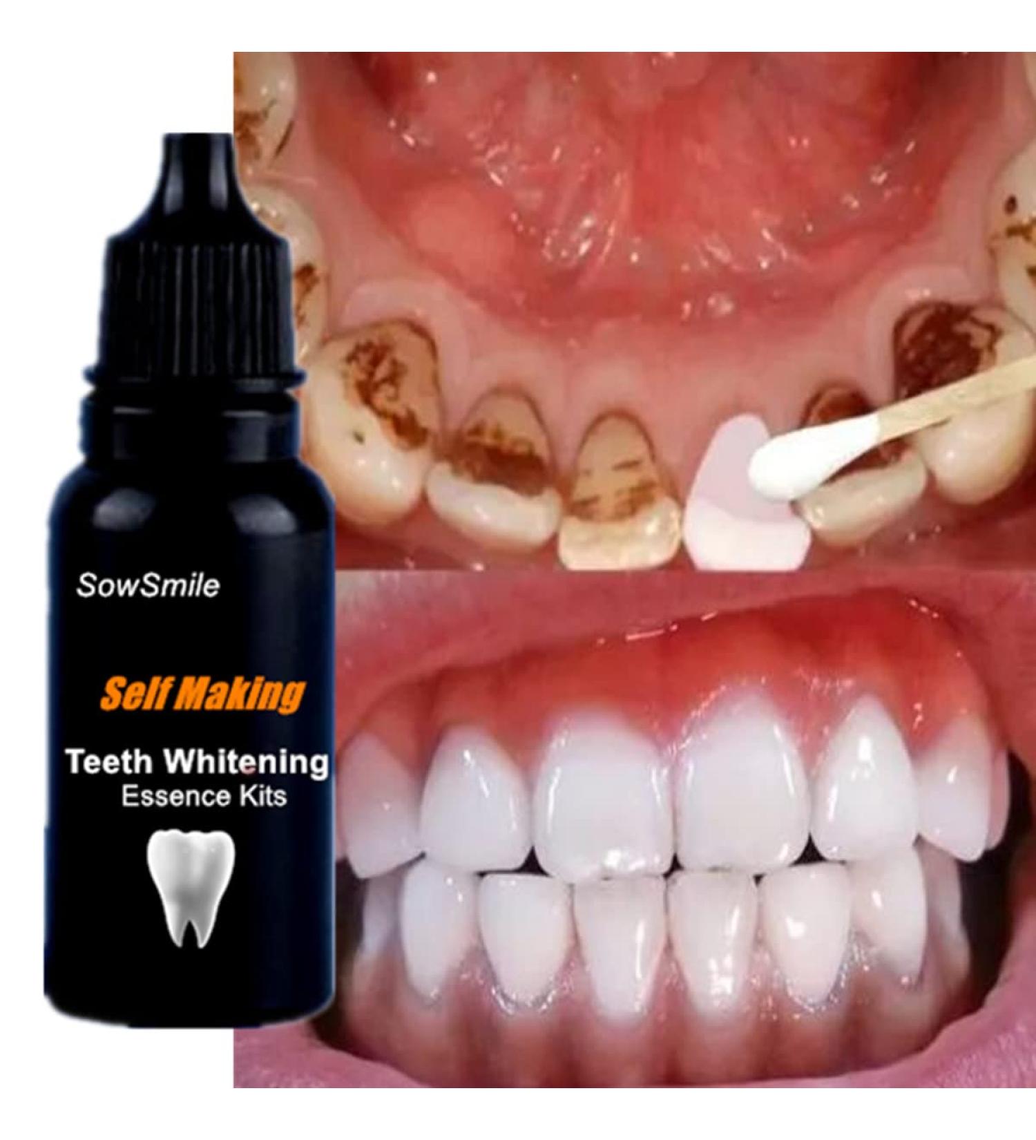 SowSmile Dental Teeth Whitening Serum - 48.0g: Oral Hygiene Whitener for Plaque Stains & Fresh Breath - Buy Online on GoSupps.com