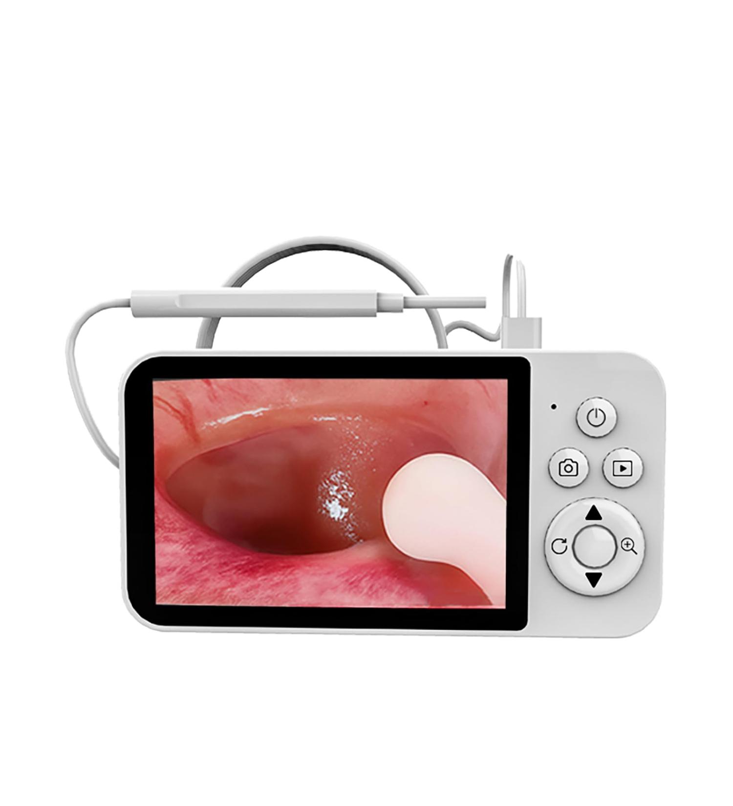 Ear Wax Removal Tool Camera Earwax Removal Kit Ear Cleaner with Camera 4.3'' Screen Earwax Remover - Buy Online on GoSupps.com