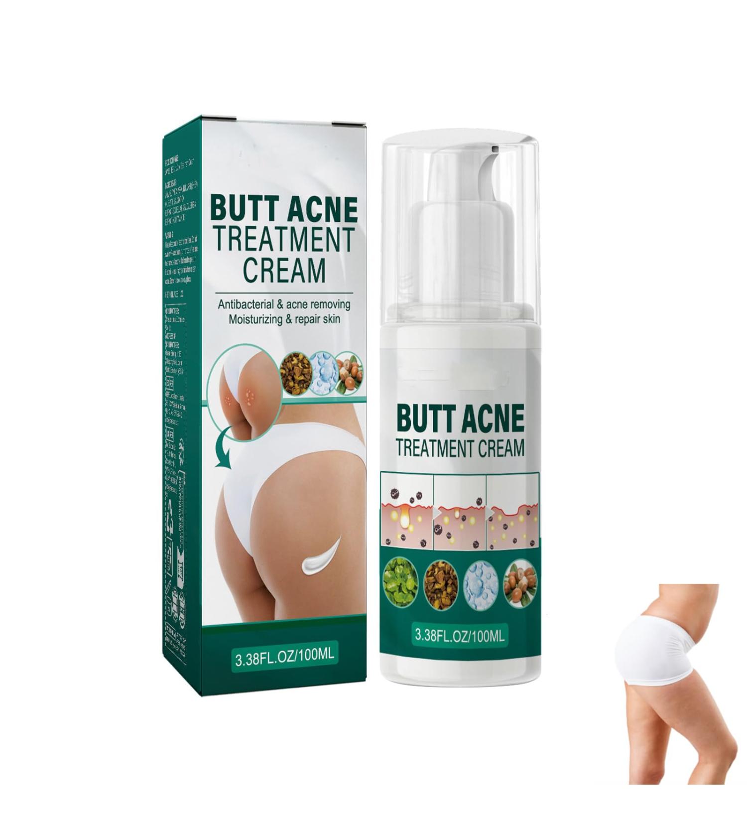  Uzionoie Butt Acne Cream Cream to Remove Acne on Buttocks Reduces Butt Pimples Restores Soft and Smooth Butt Skin 100ml - Buy Online on GoSupps.com