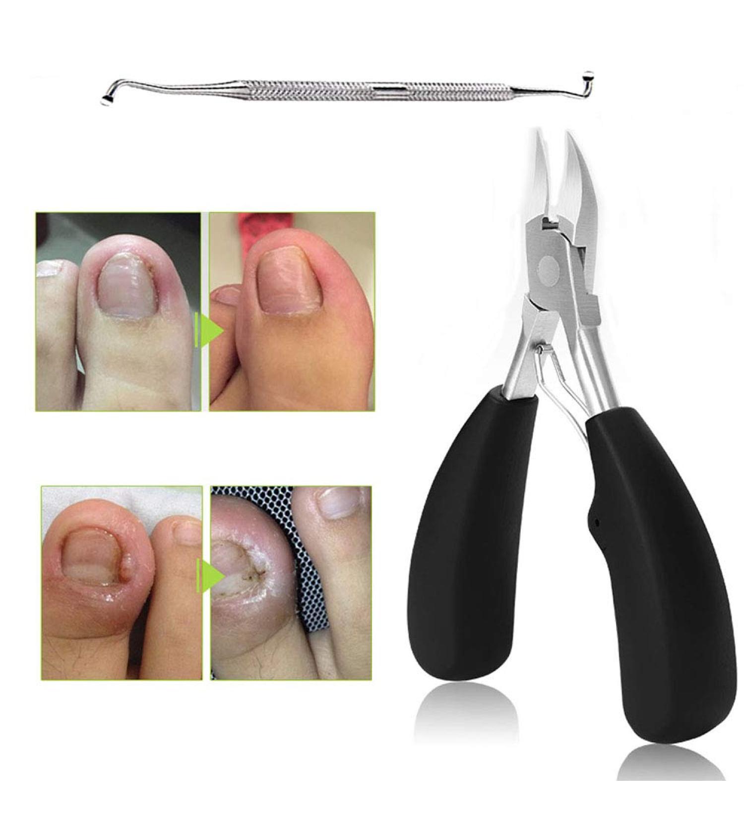 Buy Generic Professional Toenail Scissors - Stainless Steel Precision Tongs for Thick & Embedded Toenails - Ergonomic Design & Non-Wound Rubber - International Shipping Available - Buy Online on GoSupps.com