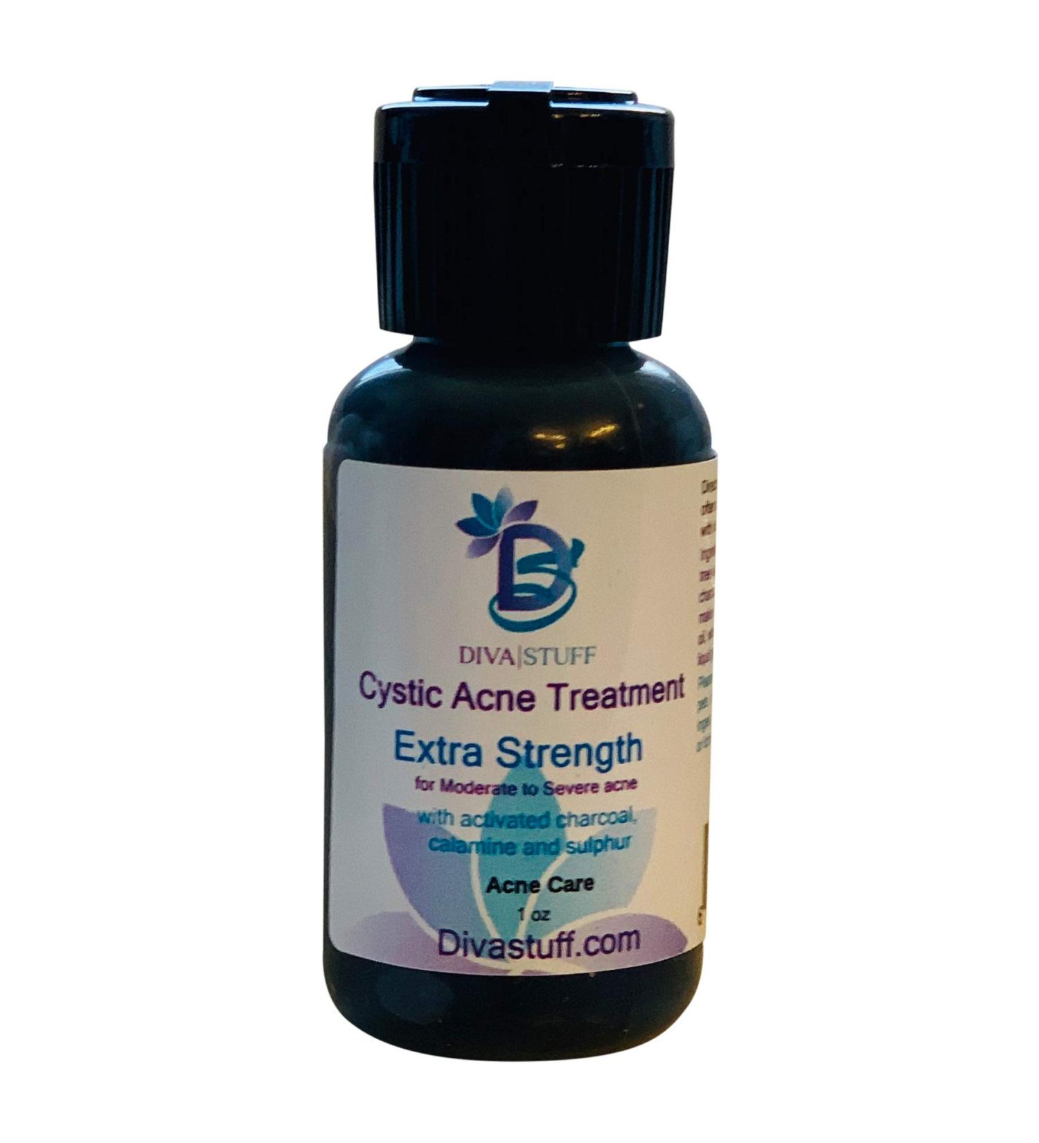 Cystic Acne Spot Treatment Bottle for Moderate to Severe Acne Made With Activated Charcoal Fast Acting Formula Reduces Inflammation and Dries Out the Blemish Quickly By Diva Stuff - Buy Online on GoSupps.com