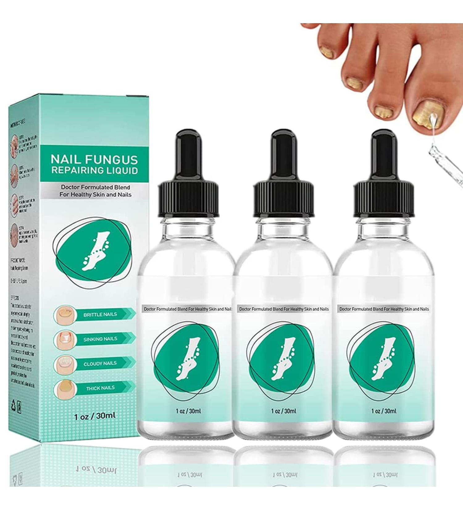 ZZBD 30ML-Kerassentials Toenail Fungus Treatment Oil Kerassentials Nail Treatment Kerassentials for Toenail Fungus for Healthy Natural Repair Nails-3pcs - Buy Online on GoSupps.com
