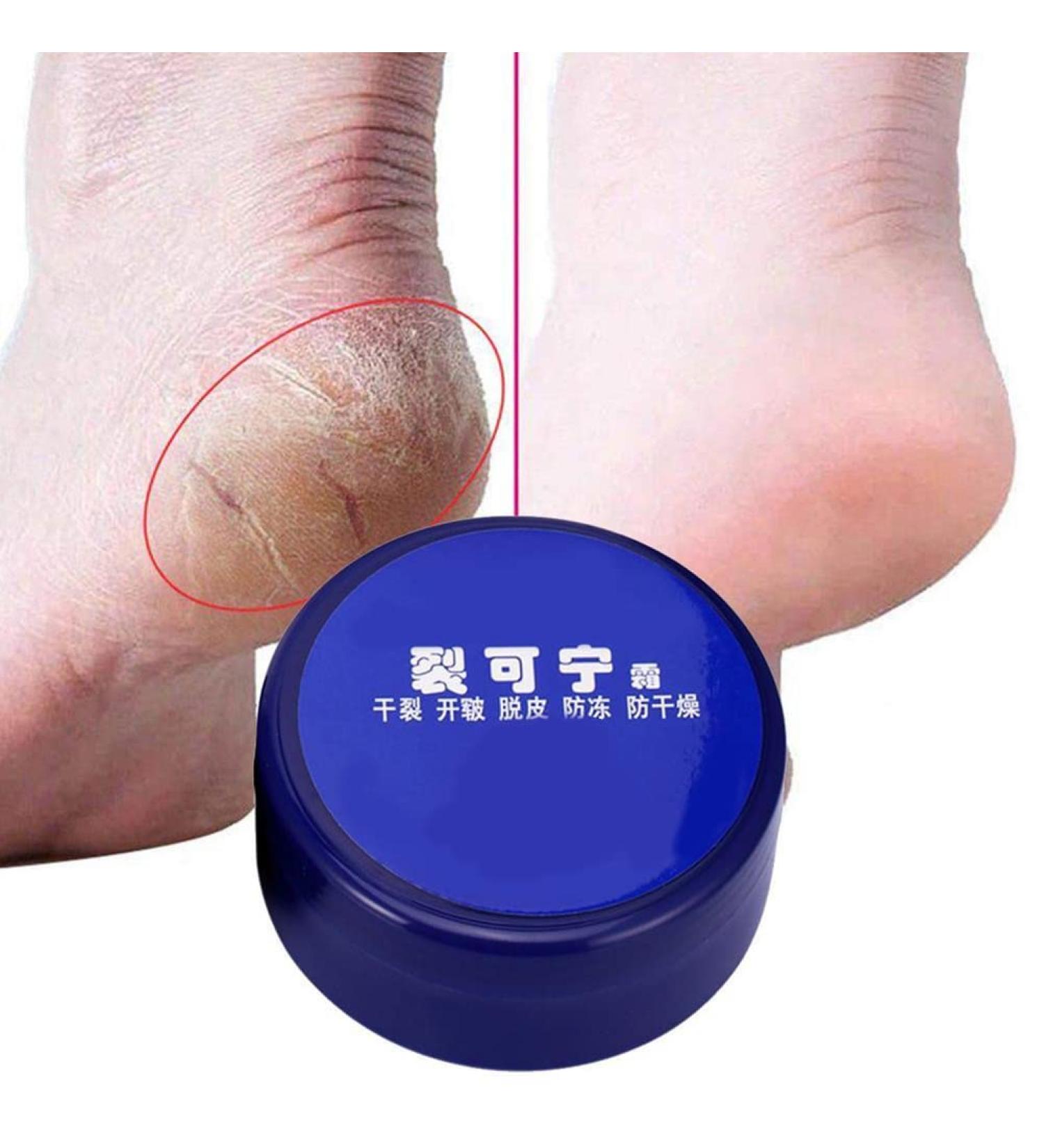 Hand Foot Crack Cream Anti Dry Chapped Cream Dry Skin Heel Chapped Peeling Ointment Hydrating Foot Cream Moisturizes for Healthy Feet Softens Conditions Dry Cracked Feet (33g) - Buy Online on GoSupps.com