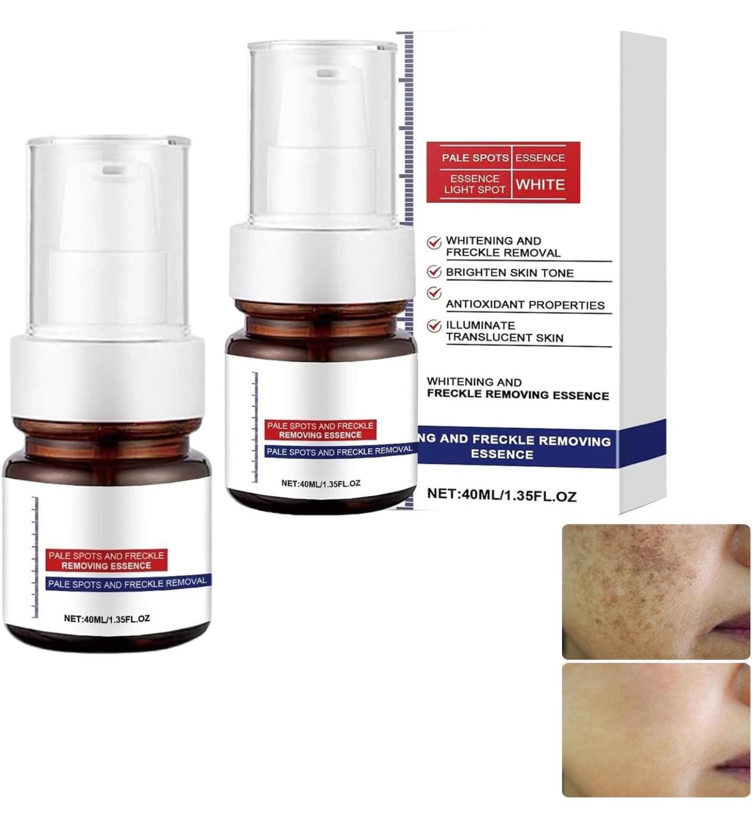 Whitening And Freckle Removing Essence Dark Spot Remover For Face Dark Spot Corrector Serum serum Whitening And Freckle Removing Essence Anti-Spot Serum (2) - Buy Online on GoSupps.com