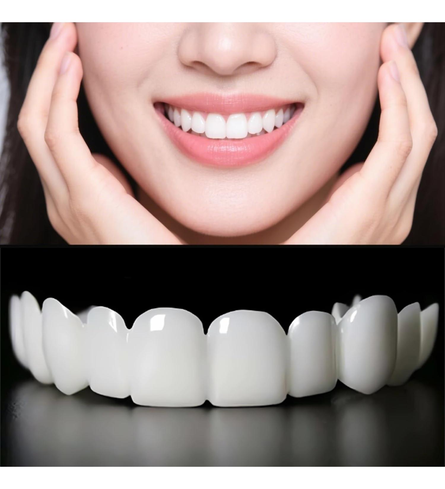 2 Pairs Men's and Women's Temporary Cosmetic Confident Smile Beautiful Smile(White) - Buy Online on GoSupps.com