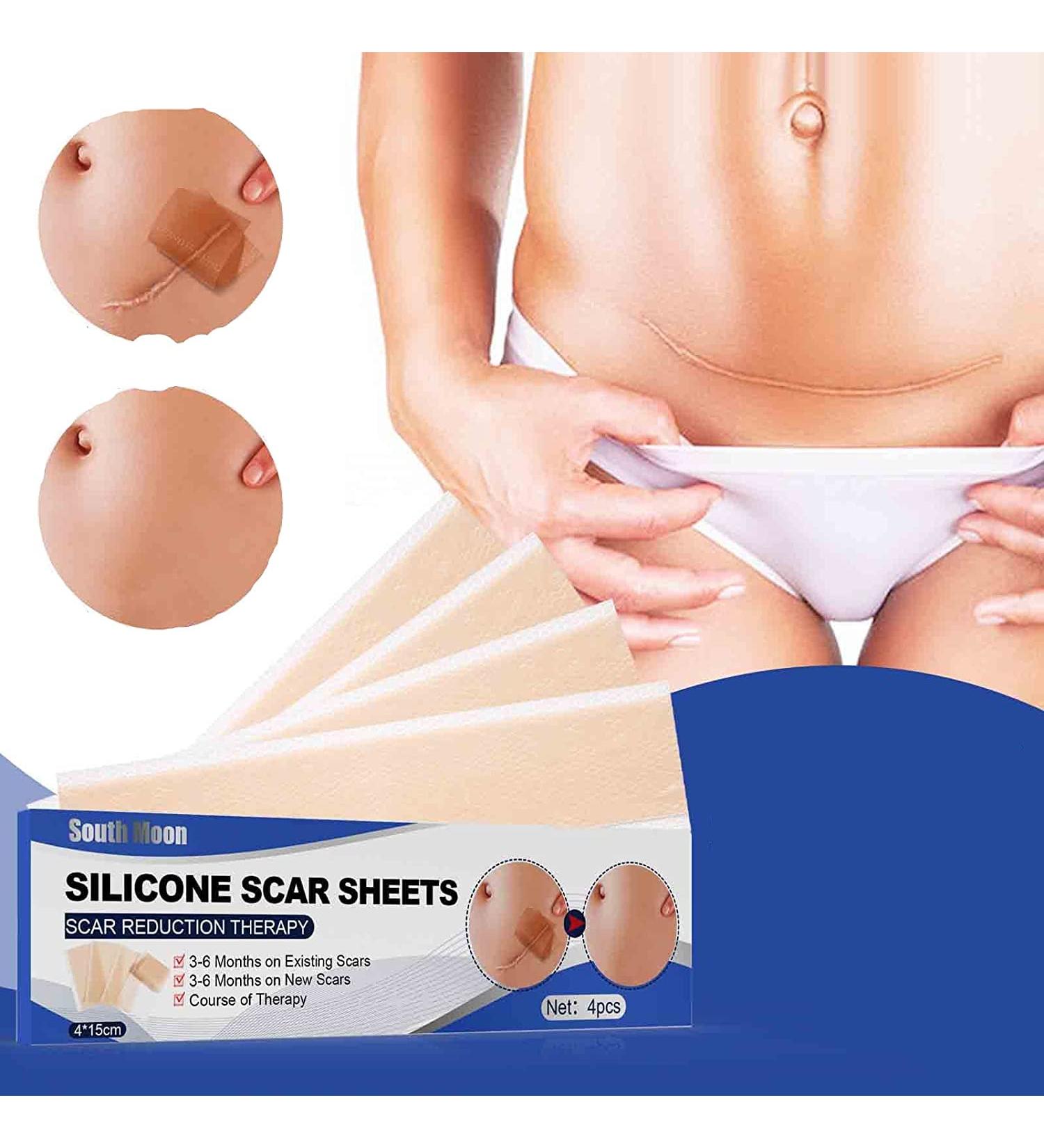 Professional Silicone Scar Removal Sheets - Breathable & Waterproof - 4 Reusable Gel Strips for Lightening Scars - Skin Color, Invisible Tape (7.5*4cm) - Buy Online on GoSupps.com