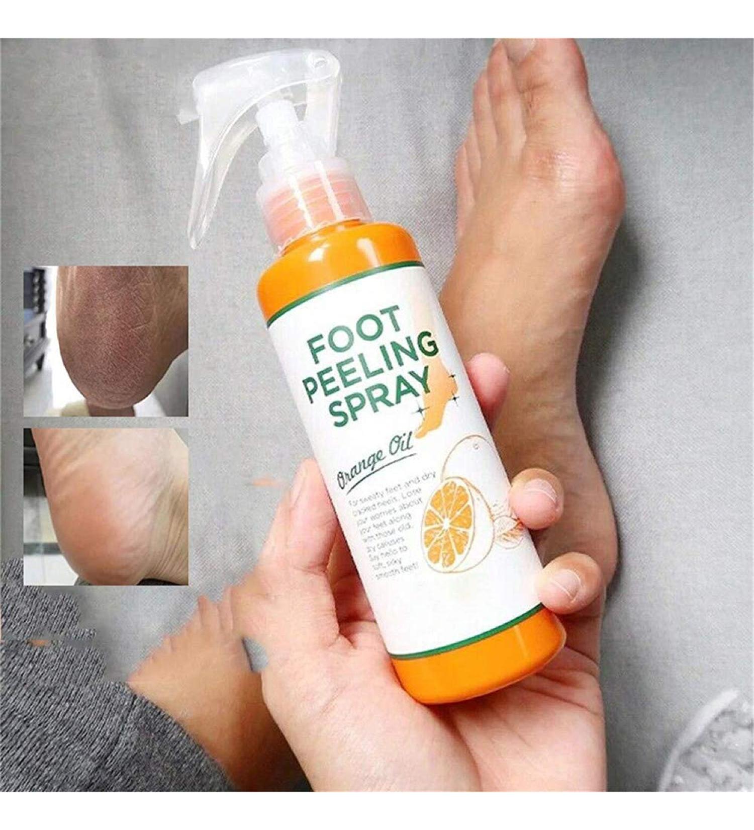 Foot Peeling Spray Natural Orange Essence Remove Foot Dead Skin Exfoliating Foot Moisturizing Hydrating Foot Peeling Spray Orange Oil for Cracked Rough Heels & Calluses - Buy Online on GoSupps.com