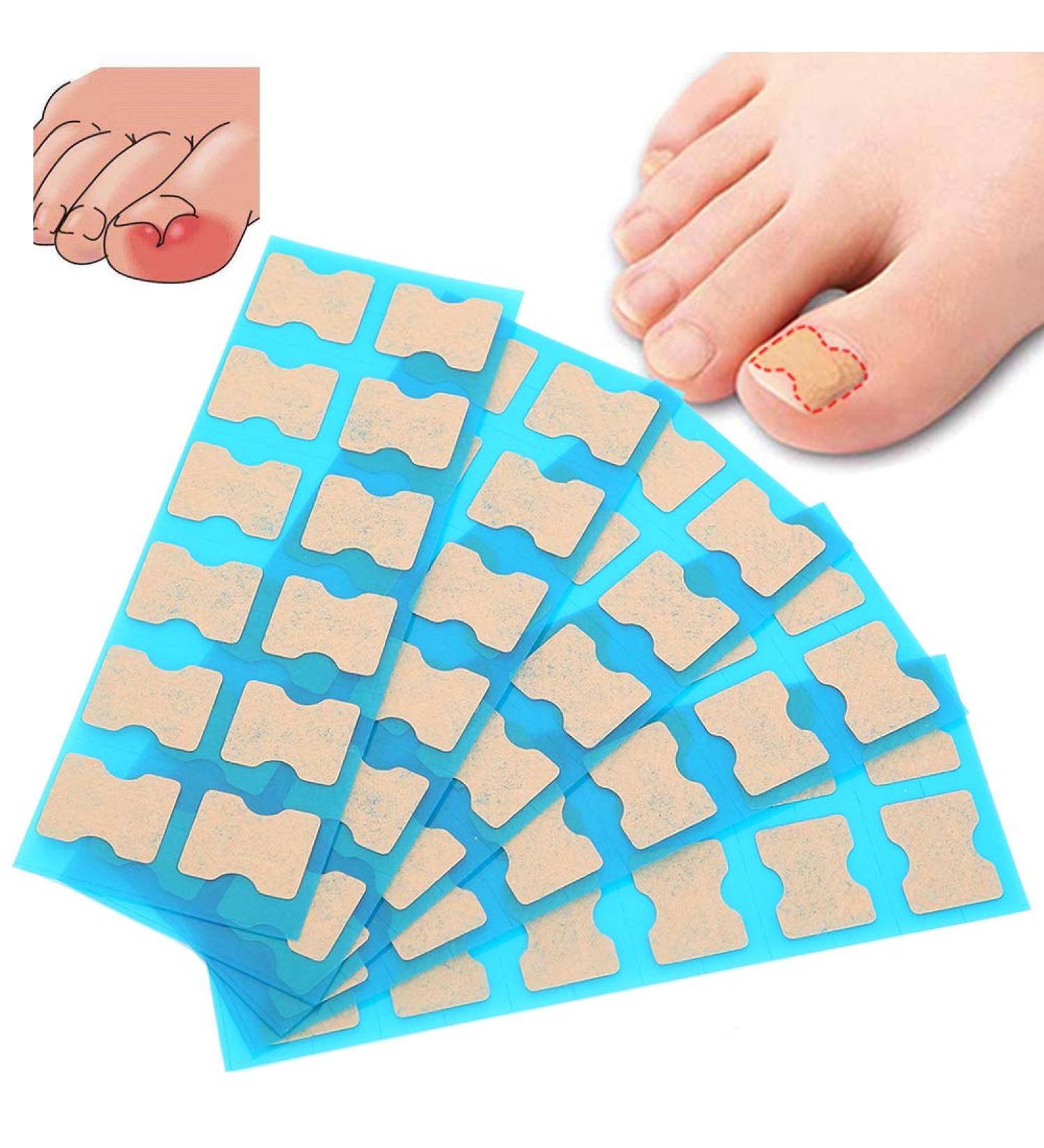 Ingrown Toenail Correction Foot Care Pedicure Sticker Corrector Ingrown Patch Relief Toe Patch Treatment Tool60pcs (60 Pieces) - Buy Online on GoSupps.com