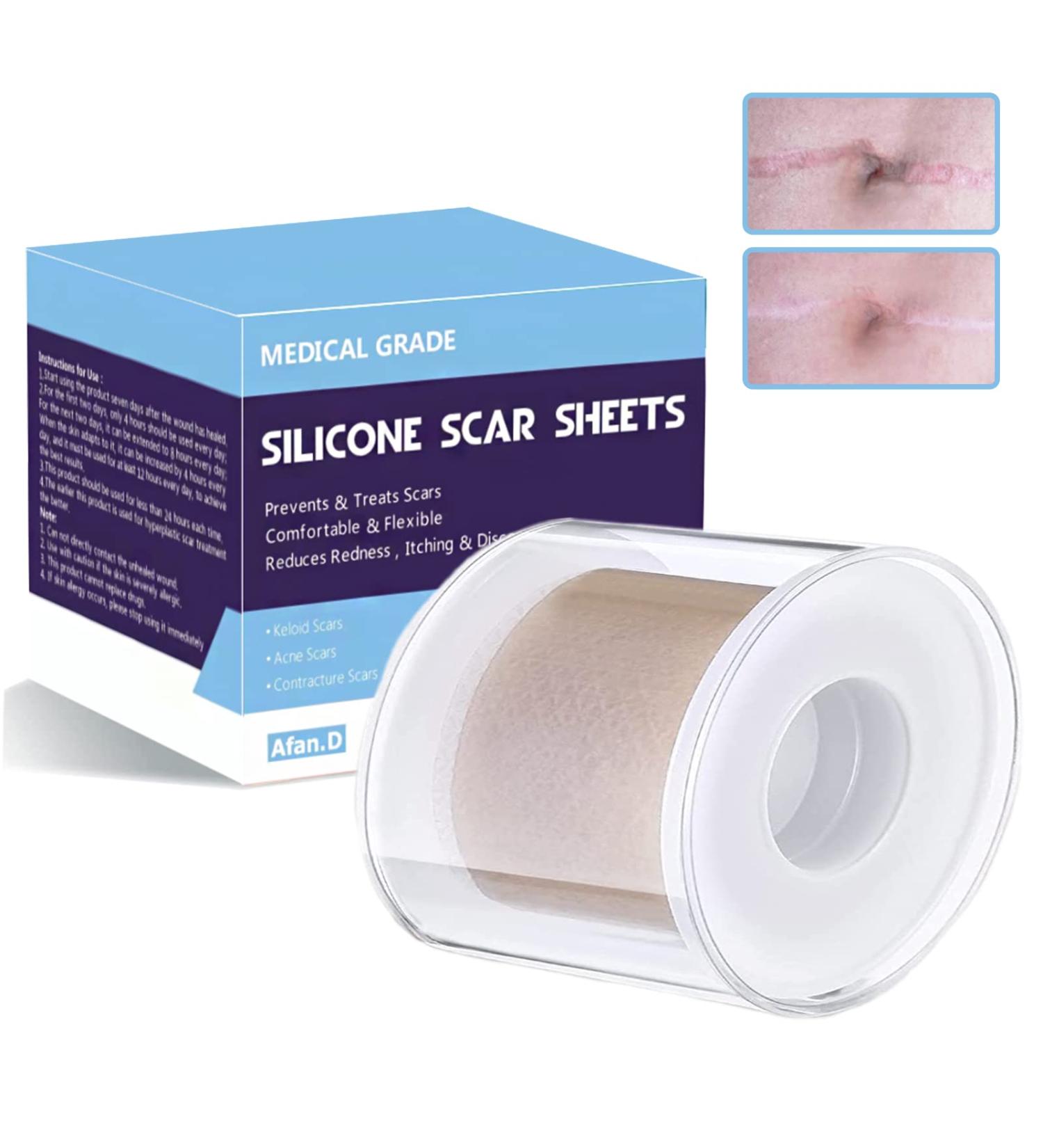 Medical Grade Scar Removal Silicone Tape (1.6x60 Roll) for Hypertrophic Scars & Keloids | Surgery, Injury, Burns, C-Section Crease | 2 Rolls - Buy Online on GoSupps.com