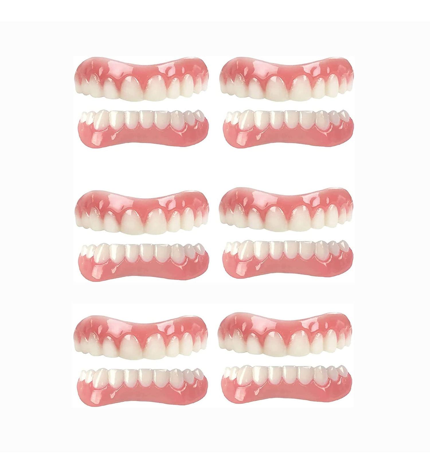 CAILING Snap On Veneers for Missing Teeth - 6 Sets Instant Denture Filling Kit - Fake Braces for Realistic Looking Teeth - Buy Online on GoSupps.com