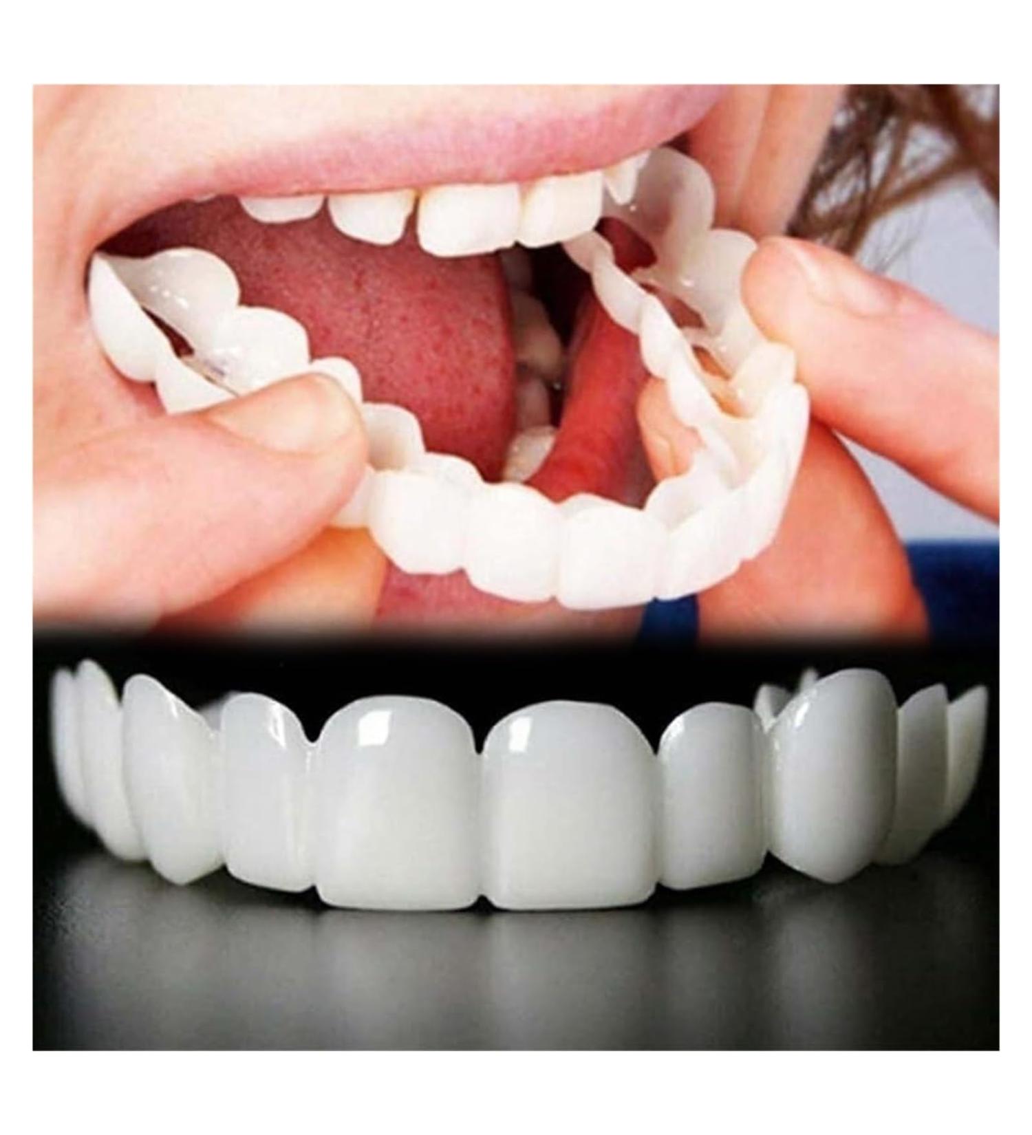 GKOKG 2 Pairs Adjustable Nature and Comfortable Top and Bottom Regain Beautiful Smile for Men and Women White - Buy Online on GoSupps.com