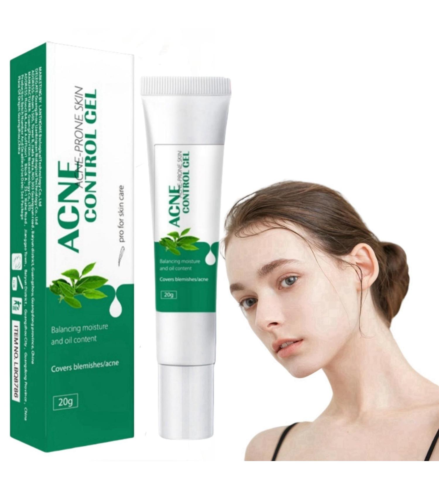 Anti Acne Face Cream Tea Tree Face Acne Gel Acne Scar Treatment Spot Cream for Acne Treatment and Spot Treatment Acne Cream Spot Treatment for Face Acne Scar Removal Cream Acne Moisturiser Face - Buy Online on GoSupps.com