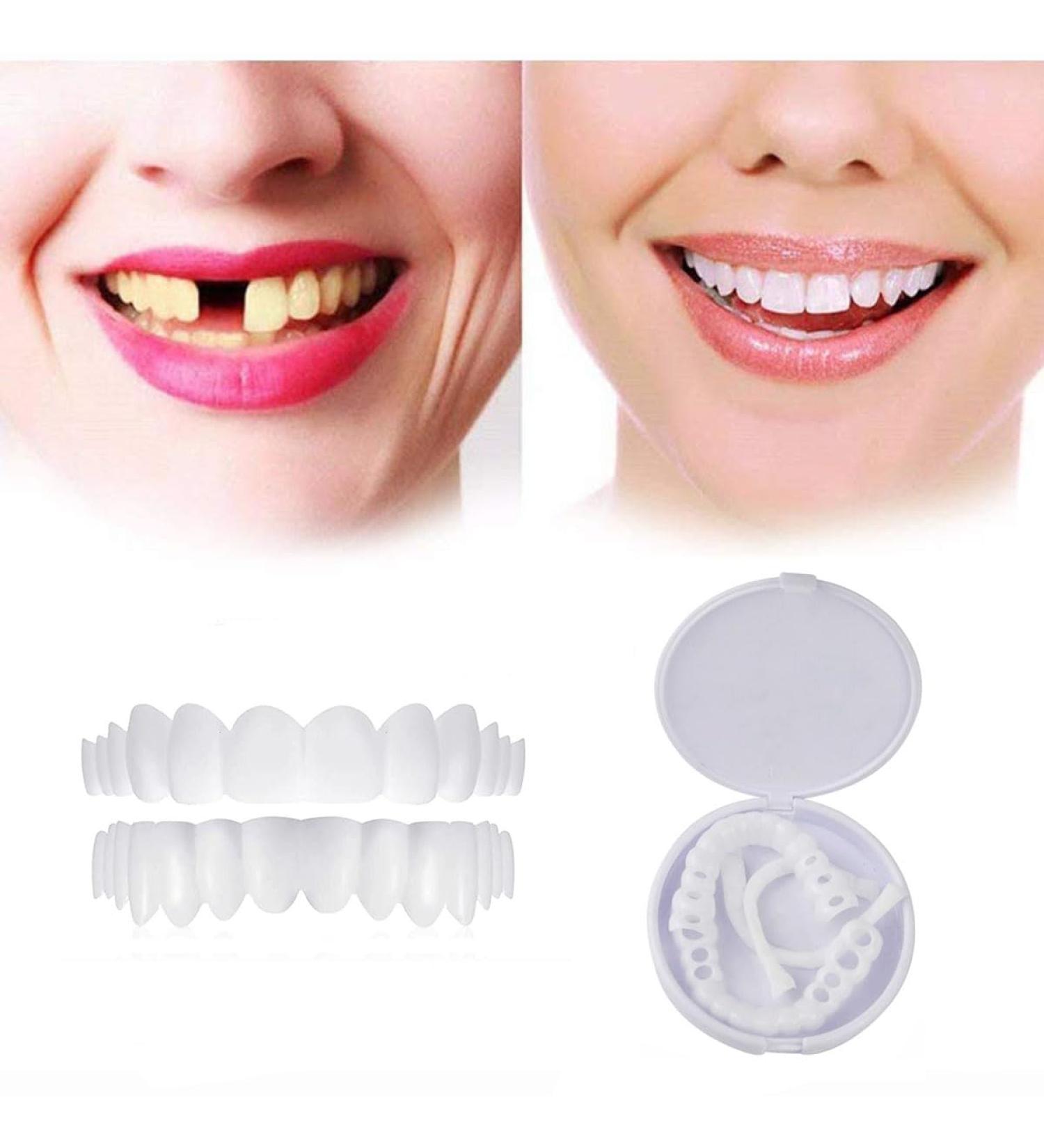 Flipped Warm Veneers Teeth Set Cosmetic Lightening Dentures for Top & Bottom Provisional Fake Teeth for Stunning Smiles - Buy Online on GoSupps.com