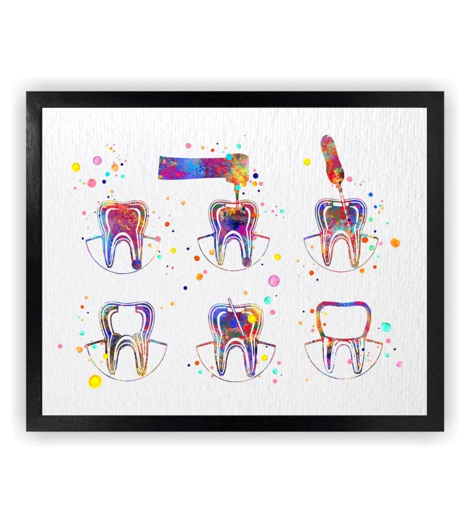 Dienovel Studios Endodontics Therapy Art Print - Watercolor Tooth & Root Canal Decor for Dental Clinics | 8x10 inch DN750 - Buy Online on GoSupps.com