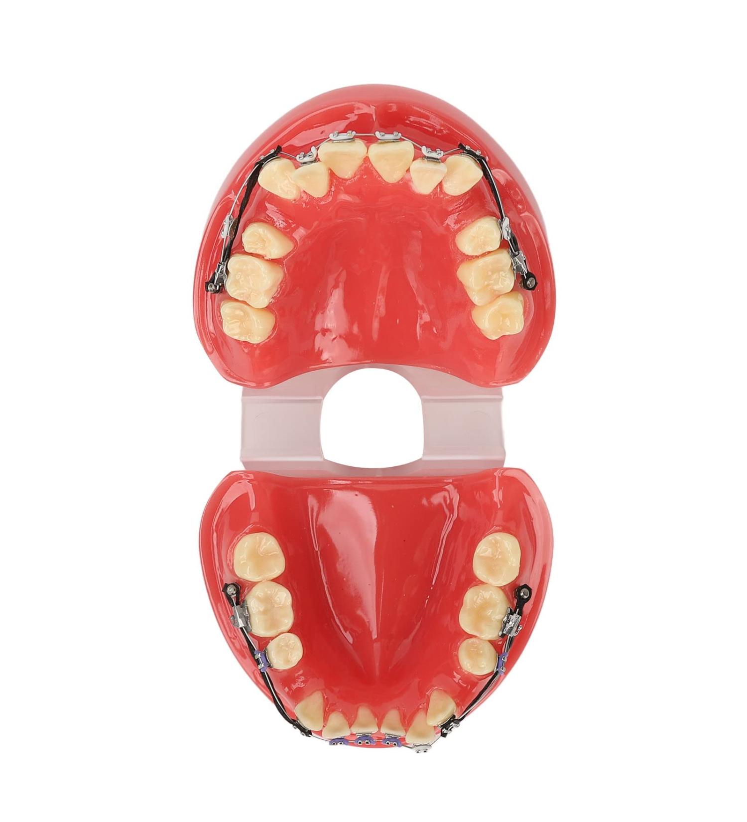 Orthodontic Bracket Model - 24 Teeth Demonstration Model with Metal Wires & Brackets for Dental Education - Buy Online on GoSupps.com