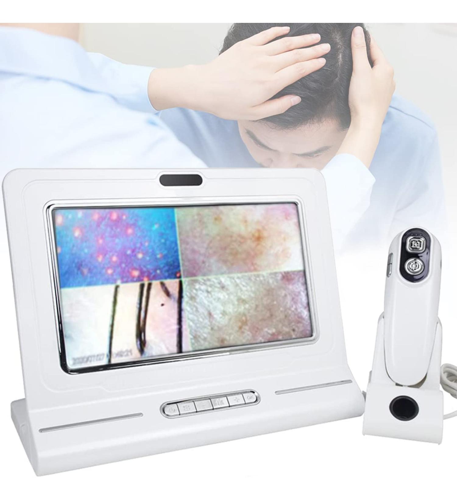 Skin Diagnosis Hair Analyzer 11 Inch LCD Screen Digital Scalp Hair Follicle Oil Moisture Magnifying Detector Analyzer Skin Pigment Tester - Buy Online on GoSupps.com