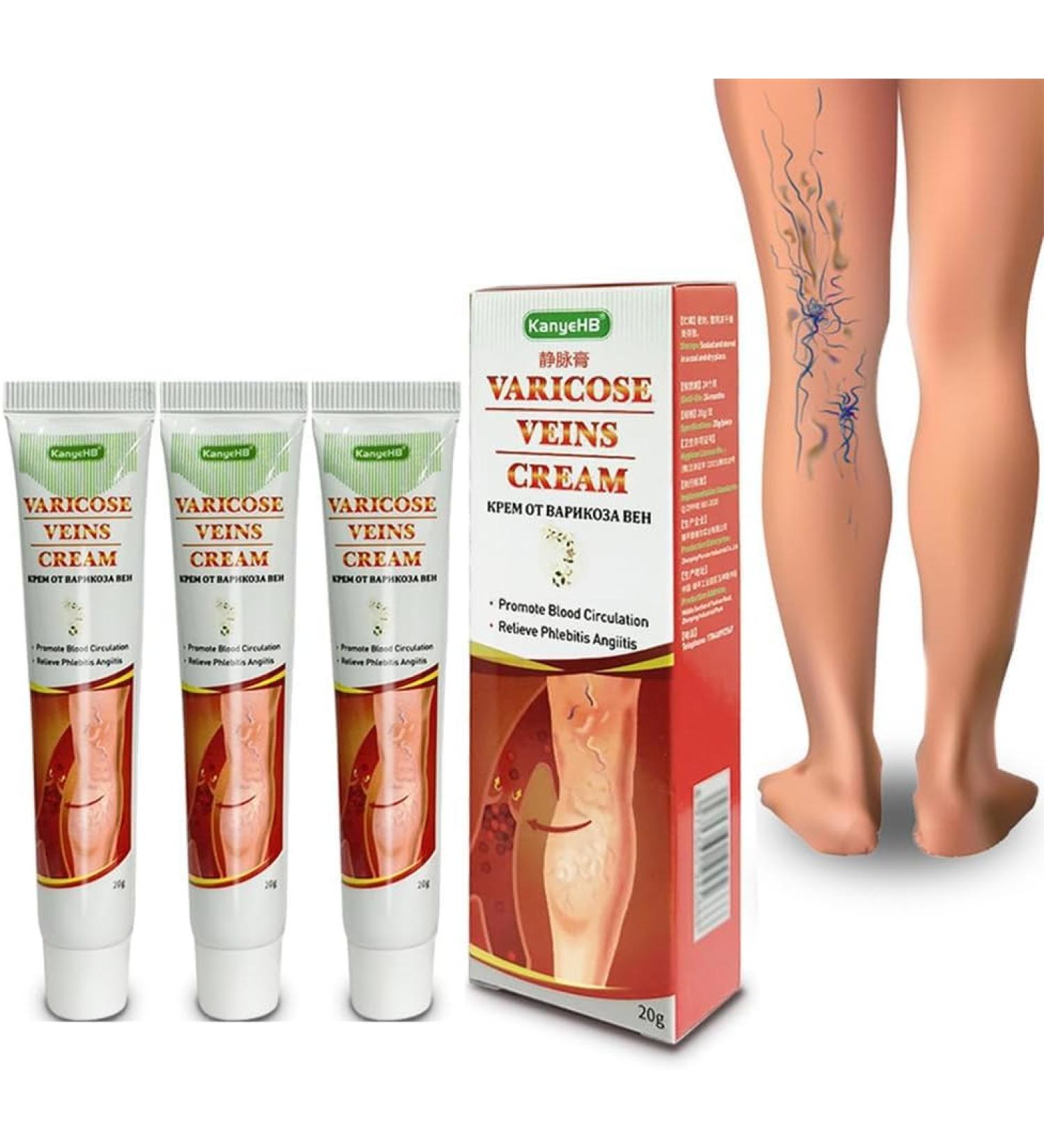 3-Piece Kanyehb Varicose Vein Relief Cream | Effective Treatment for Varicose Veins on Legs & Broom Travelers - Buy Online on GoSupps.com