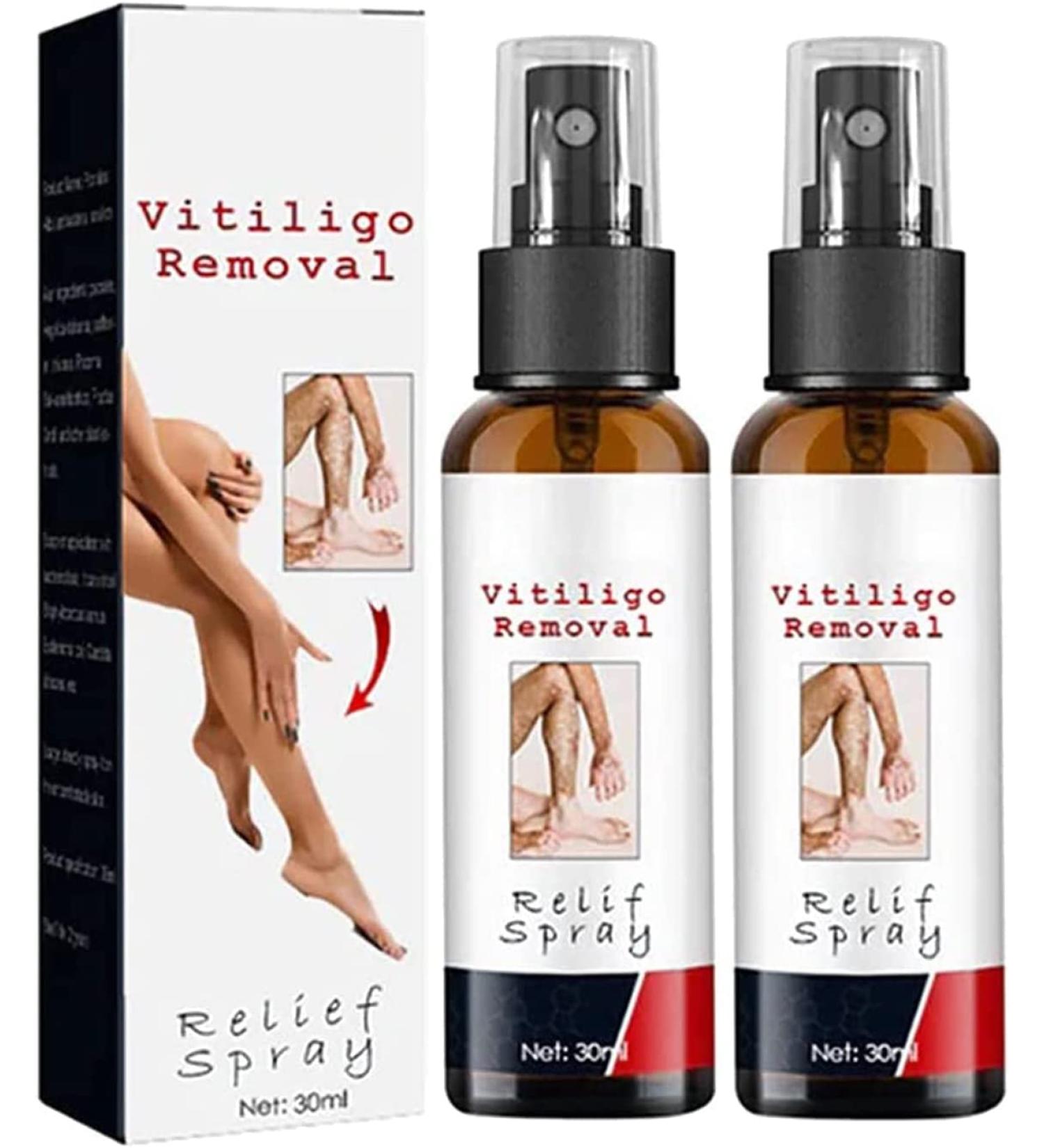 Vitiligo Treatment Spray - Skin Pigmentation Care & White Spot Reduction (2pcs) - Buy Online on GoSupps.com