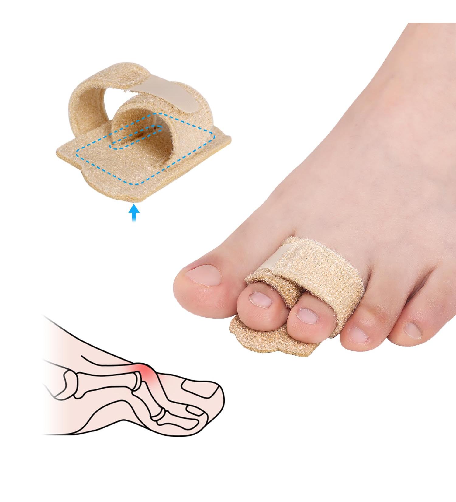 Pozpo Tech hammer toe correctors toes smooth iron for women and men broken rails bandages for malet toes crooked toes claws toes with aluminum plate support - 1 pieces