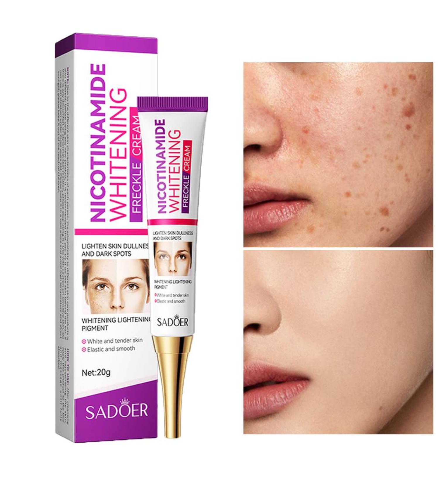 Dark Spot Remover for Face - Nicotinamide Whitening Cream for Melasma & Hyperpigmentation | Visible Results in 28 Days - 0.7 oz - Buy Online on GoSupps.com