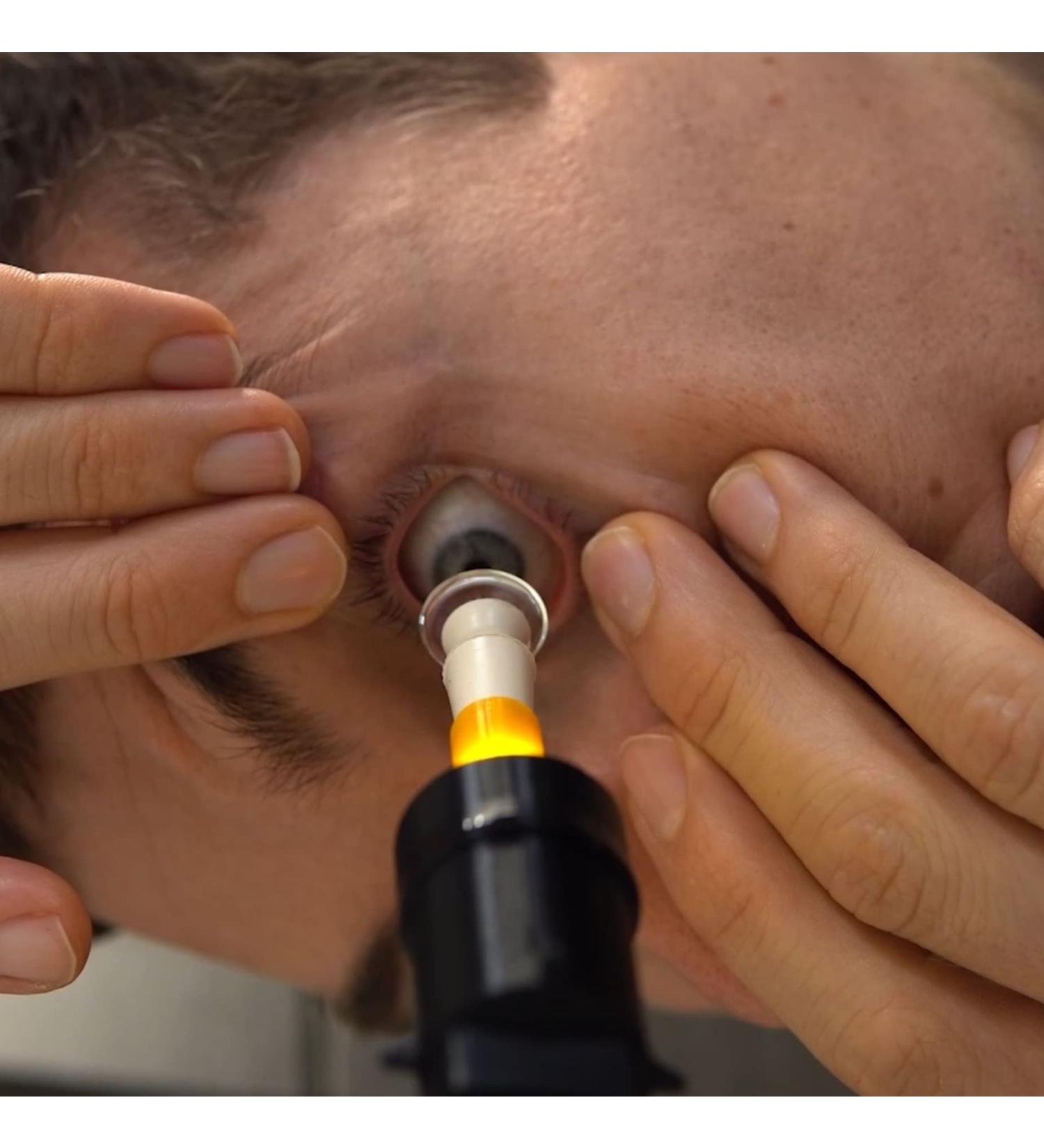 S5 Mini : Effortless Scleral & Hybrid Lens Insertion Tool for Perfect Eye Alignment - Buy Internationally - Buy Online on GoSupps.com