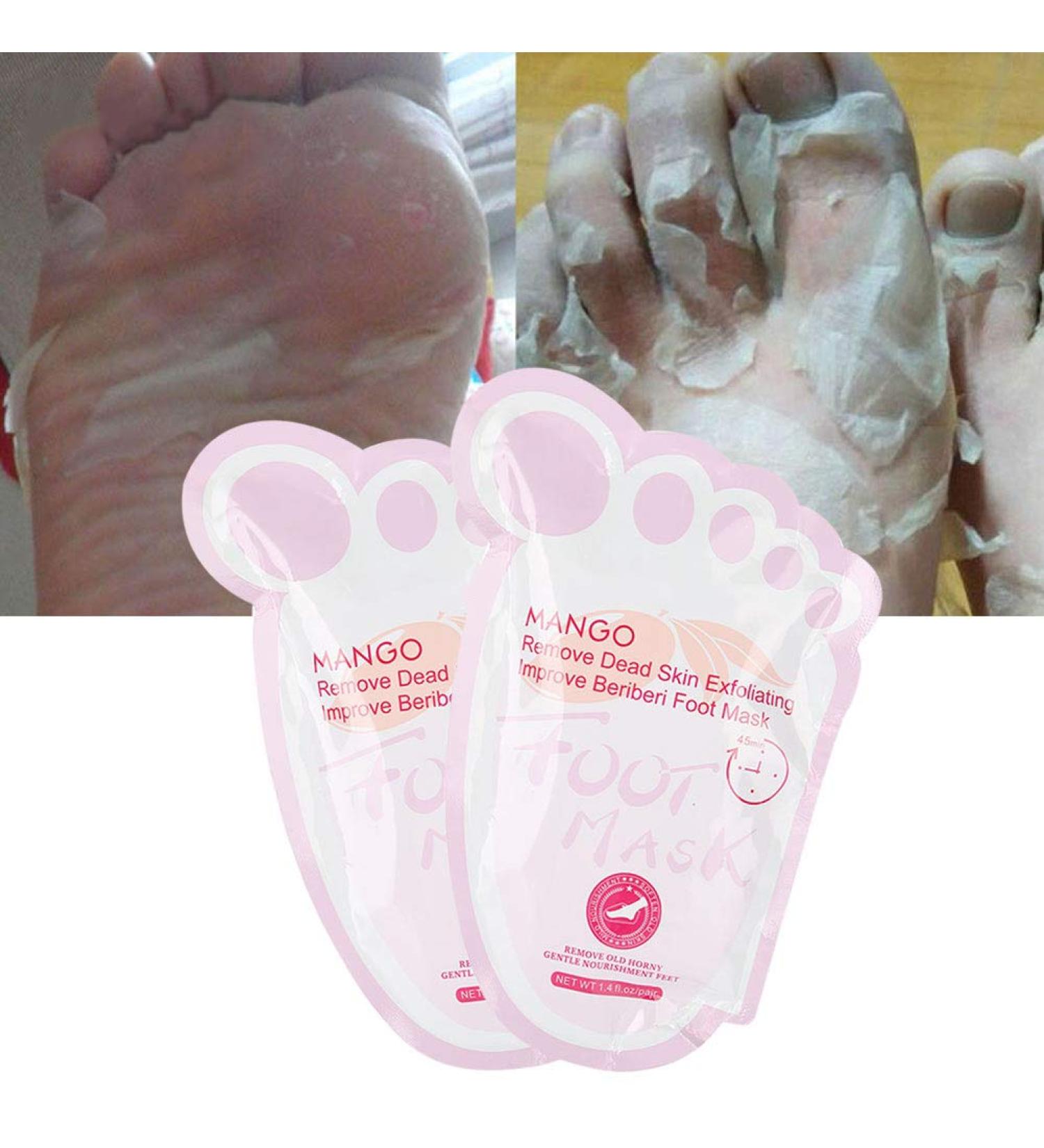 Foot Masks Peeling 5 Pairs Moisturizing Socks for Dead Skin Removal & Repair | International Shipping Available - Buy Online on GoSupps.com