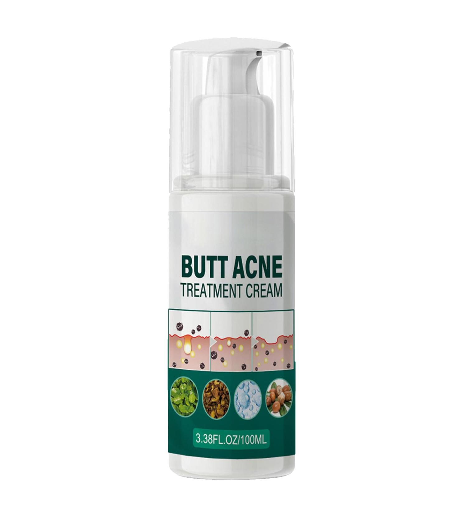 Butt Pimple Clearing Treatment Cream Butt Acne Treatment Butt Acne Treatment Balance Oil Butt Acne Clearing Spot Treatment Cream Butt Pimple Removing Cream Butt And Thigh Acne Treatment Cream 100ml - Buy Online on GoSupps.com