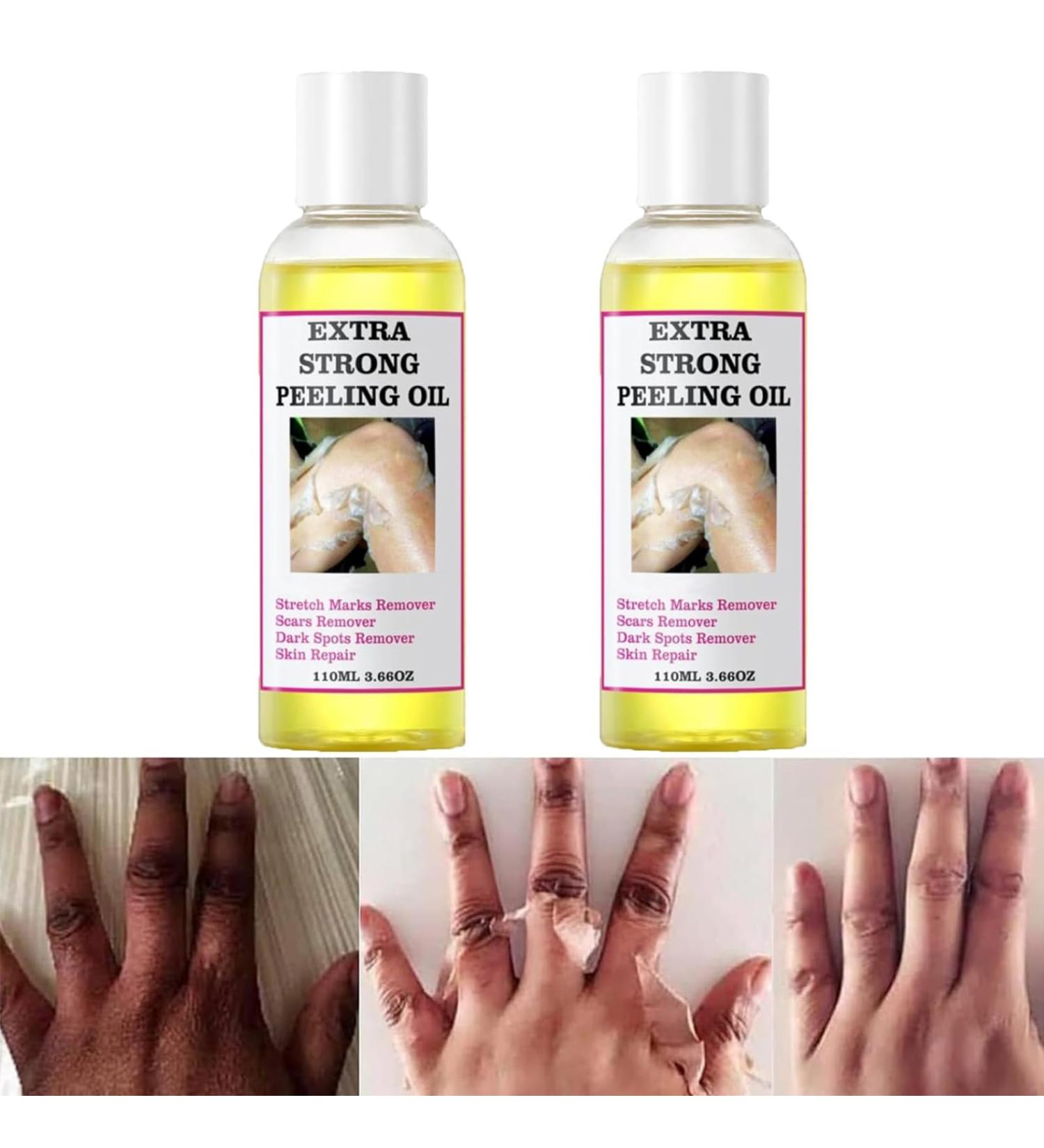 Chemical Peel Oil for Face & Body Extra Strong Yellow Peeling Oil for Dark Skin Remover Chemical Exfoliant Peel Solution with Gentle Formula for All Skin Type - 3.88 FL.Oz/110 ML (2 PCS) - Buy Online on GoSupps.com