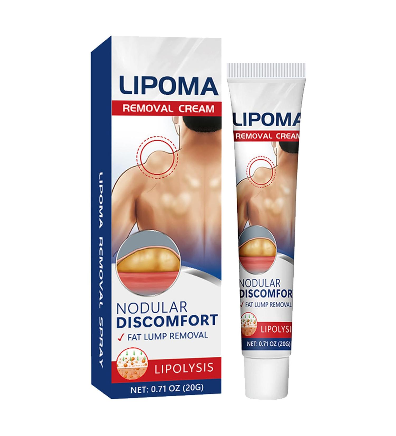 Cr me Naturelle D' limination des Lipomes Cr me D' limination des Lipomes V g taux Lipoma Elimination Cream Doux et Non Stimulant 1PC - Buy Online on GoSupps.com