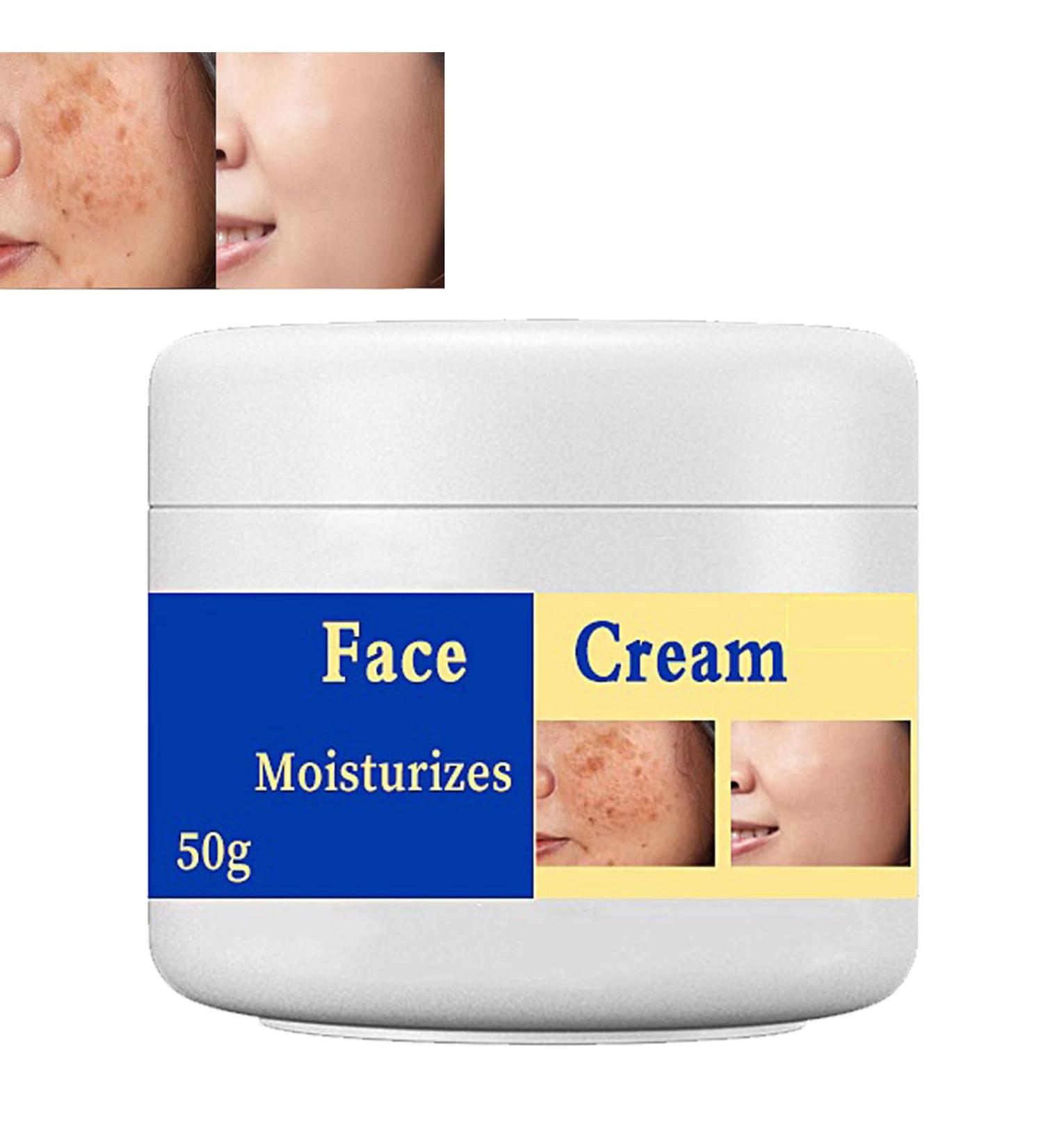 Melasma Treatment for Face Removes Facial Melasma Dark Spots Spot Cream Hyperpigmentation Treatment Sun Spots and Melasma Freckle Remover Remove Dark Spots Pigmentation Removal Cream for Face - Buy Online on GoSupps.com