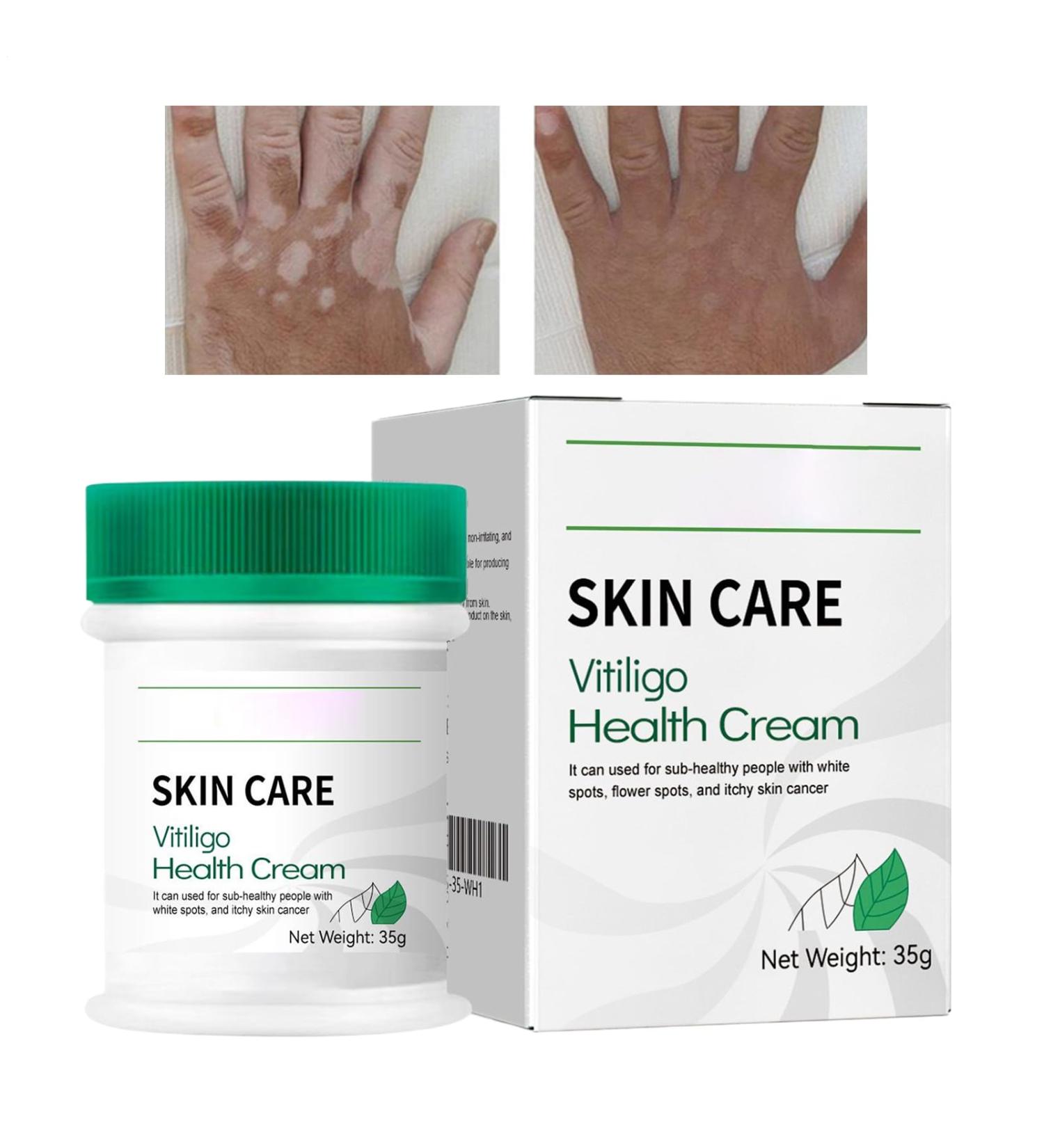 Skin cream 35 g whitening lotion nongreasy body moisturizing lotion for women for face and body for night and day for beauty care at home on the go - Buy Online on GoSupps.com