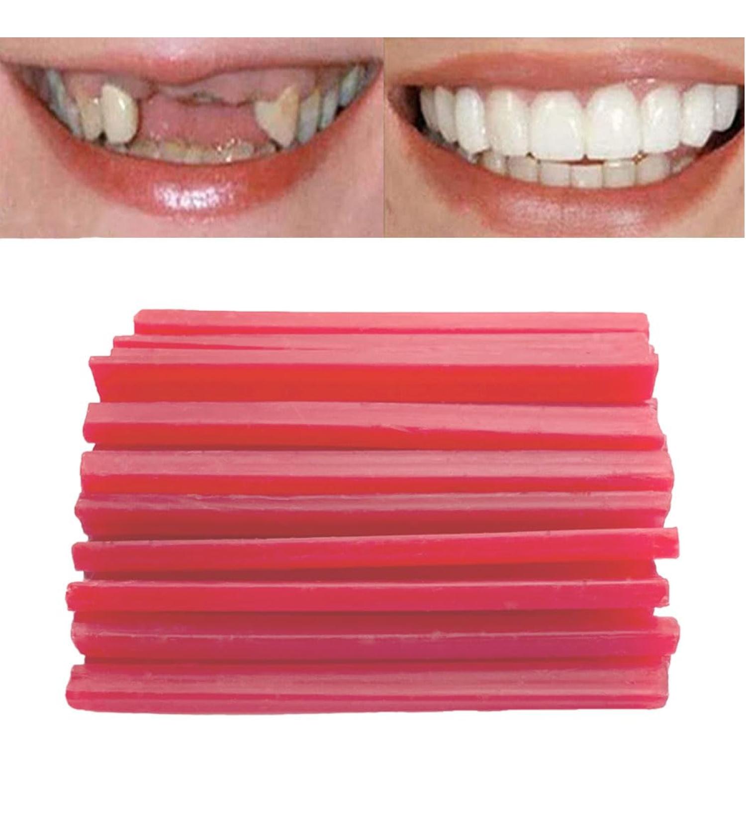 Buy Fake Tooth DIY Kit | Temporary Partial & Full Dentures | Tooth Fixing Kit for Confident Smile - Buy Online on GoSupps.com