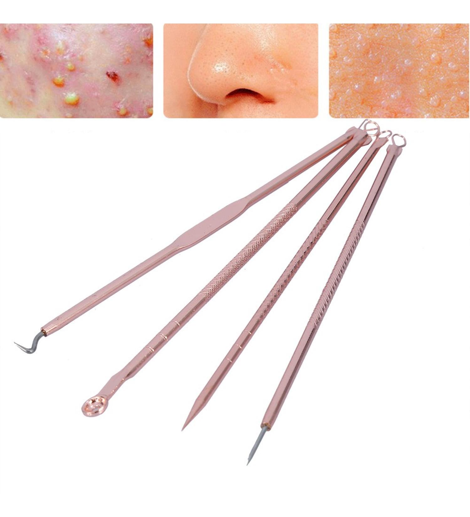 4-Piece Blackhead Remover Kit | Stainless Steel Acne Removal Tools & Comedon Extractor | Pimple Treatment Set - Buy Online on GoSupps.com