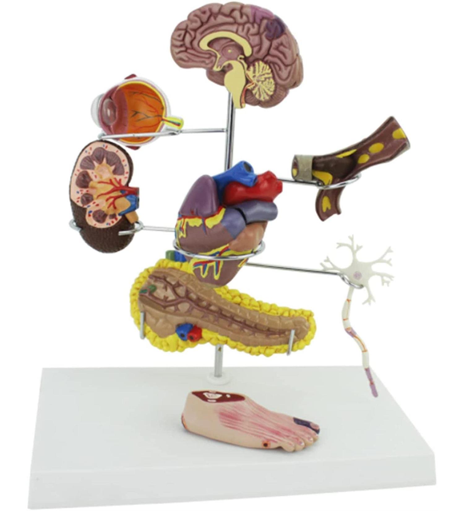 Diabetes Model Set Diabetes ICal Model Human Organ Coronary Artery Thrombosis Model Arteriosclerosis in Vitro - Buy Online on GoSupps.com