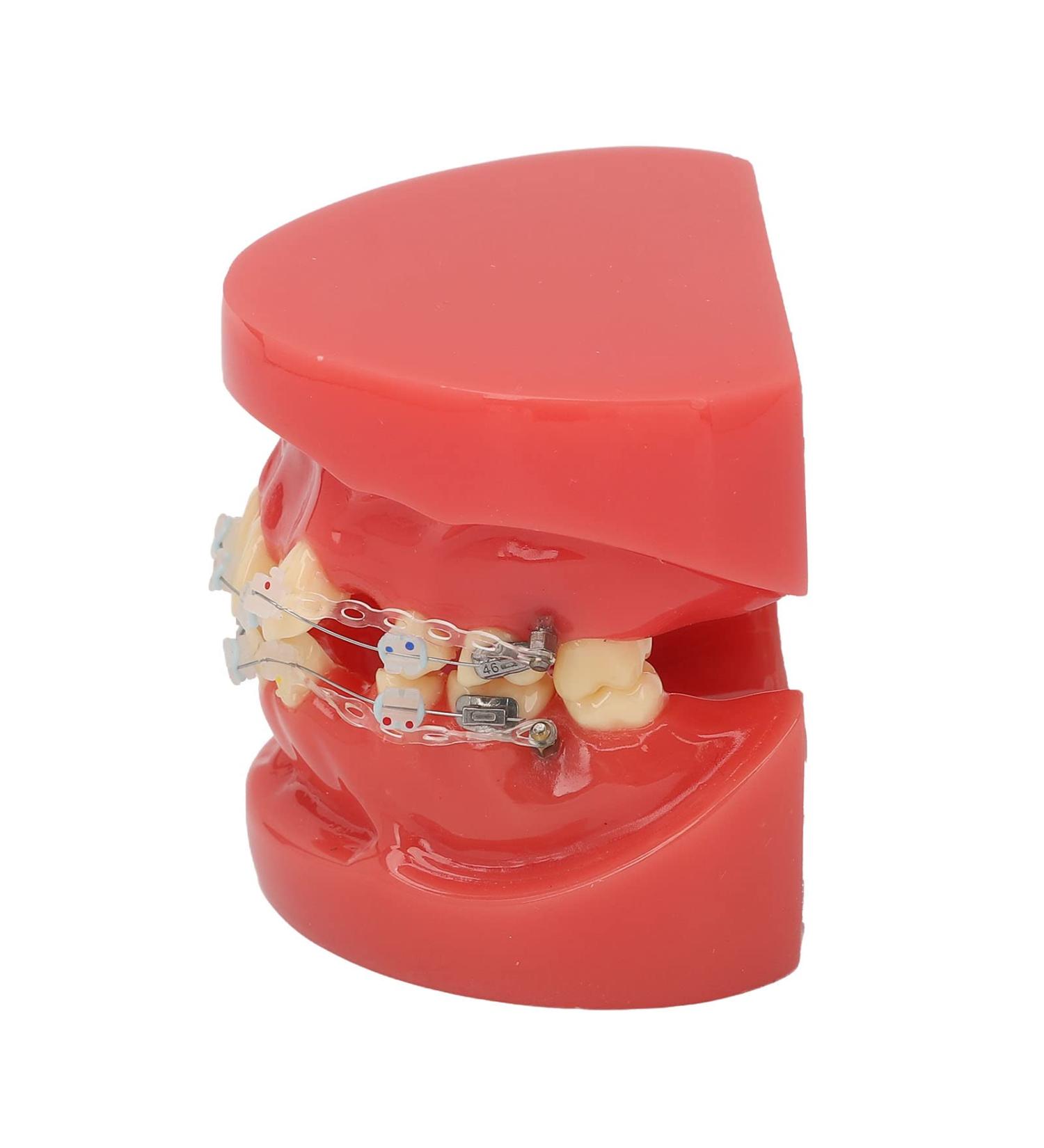 Orthodontic Model 24 Teeth with Metal Wire Case - Ideal for Dental Hospitals | International Shipping Available - Buy Online on GoSupps.com
